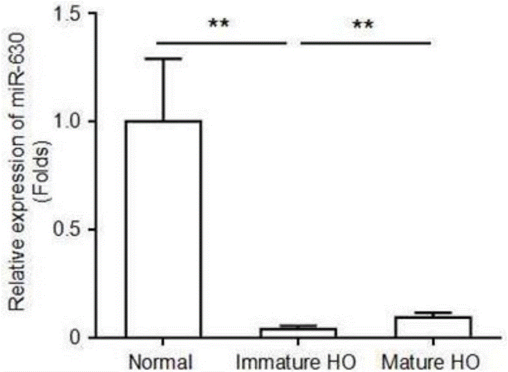 Fluorescence real-time quantitative PRC detection kit for serum miR-630 and application of miR-630