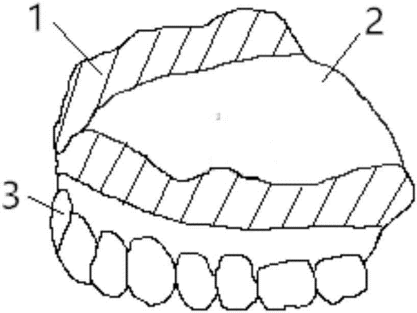 Complete denture and preparation method thereof