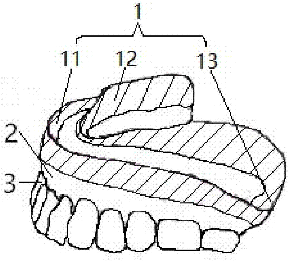 Complete denture and preparation method thereof