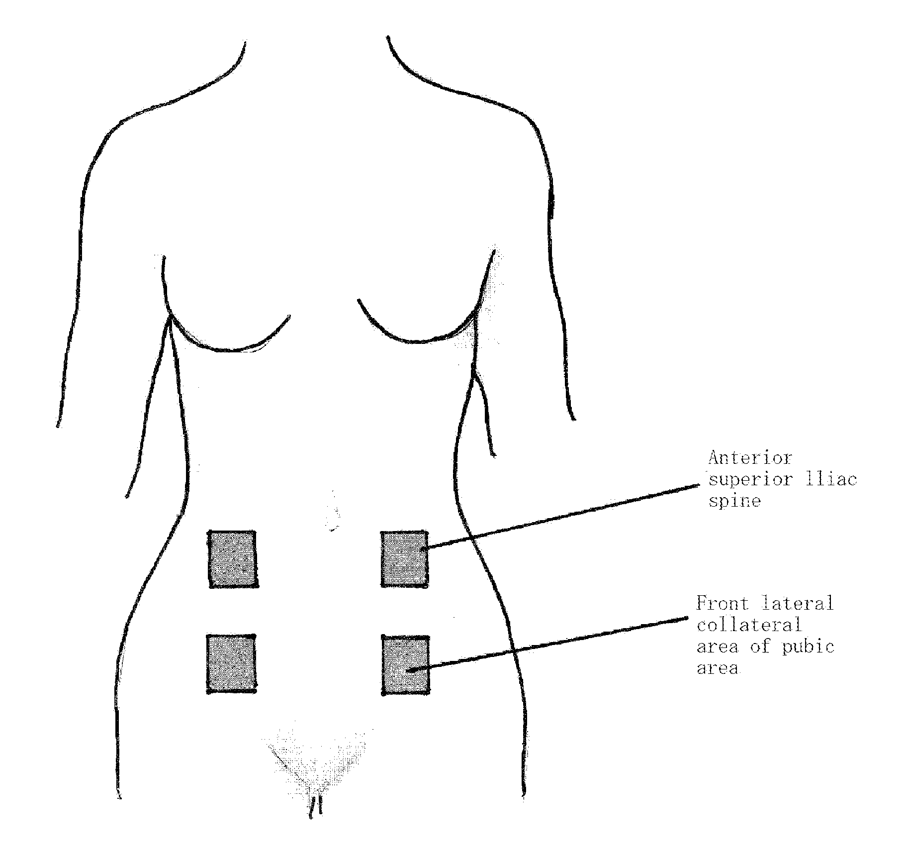 Portable combined stimulation device for alleviating menstrual pain