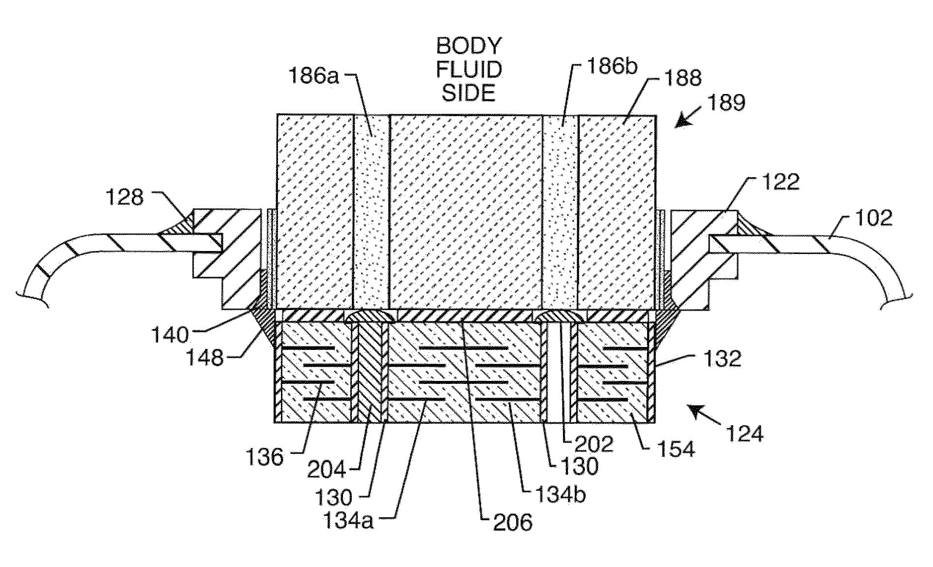 Co-fired hermetically sealed feedthrough with alumina substrate and platinum filled via for an active implantable medical device