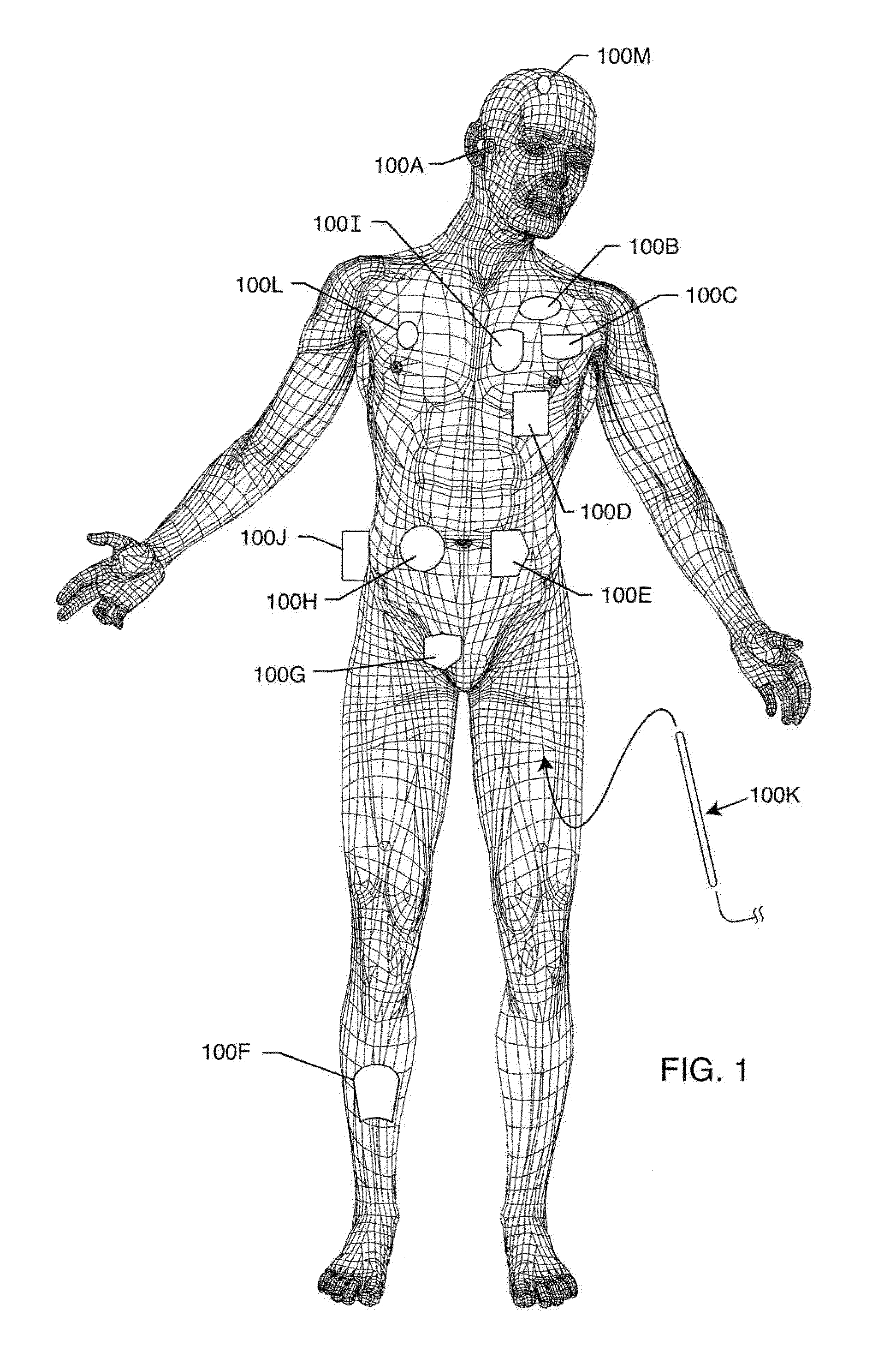 Co-fired hermetically sealed feedthrough with alumina substrate and platinum filled via for an active implantable medical device