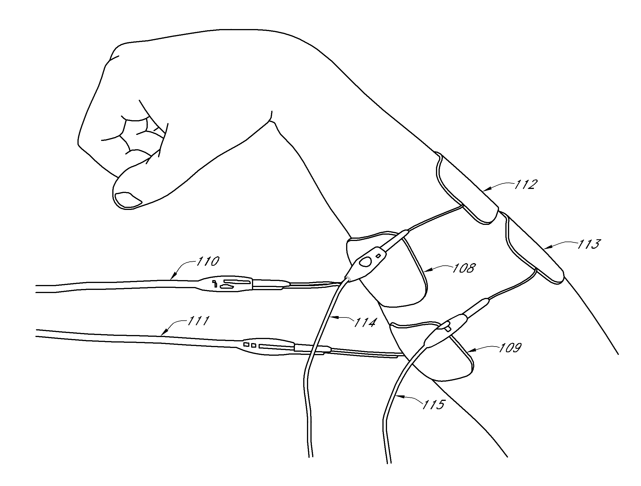 Method and apparatus for applying neuromuscular electrical stimulation