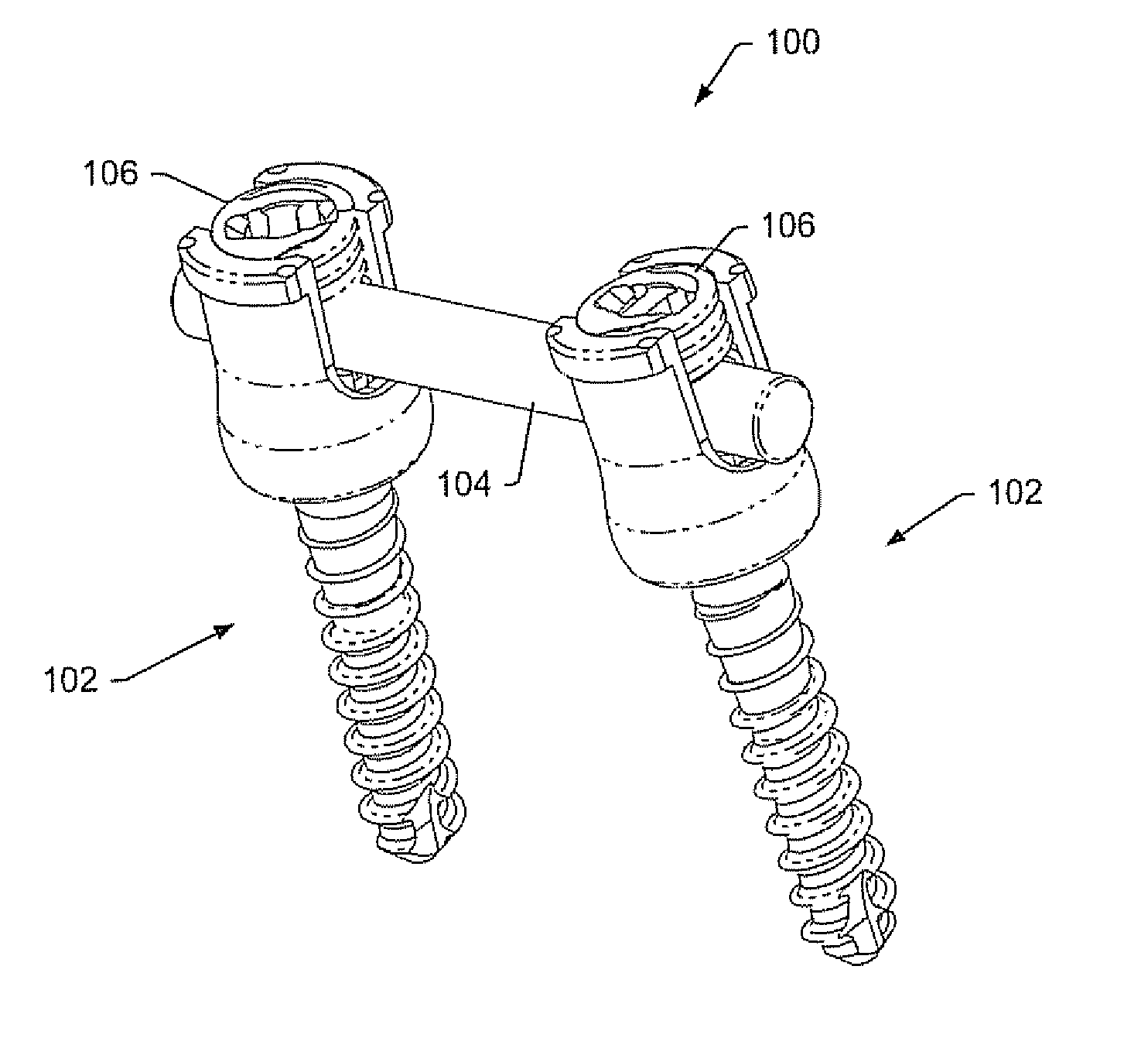 Instruments and methods for reduction of vertebral bodies