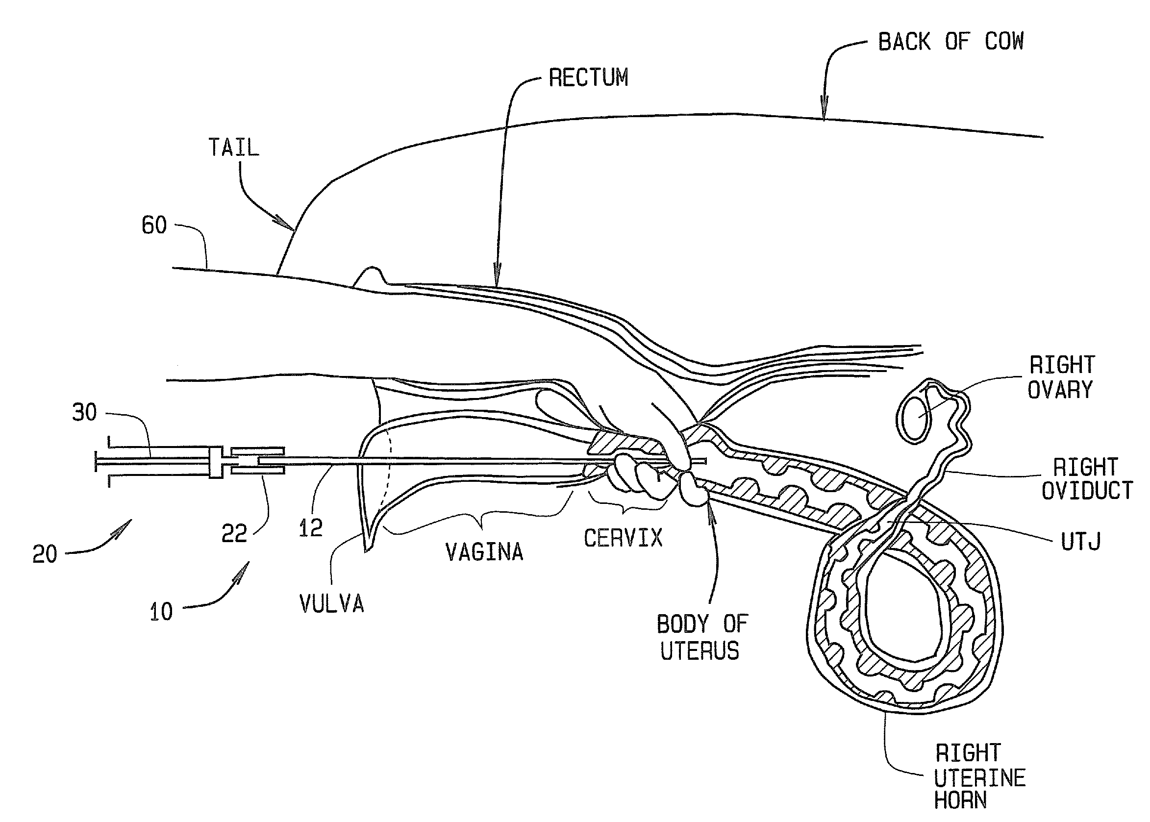 Artificial breeding techniques for bovines including semen diluents and AI apparatus