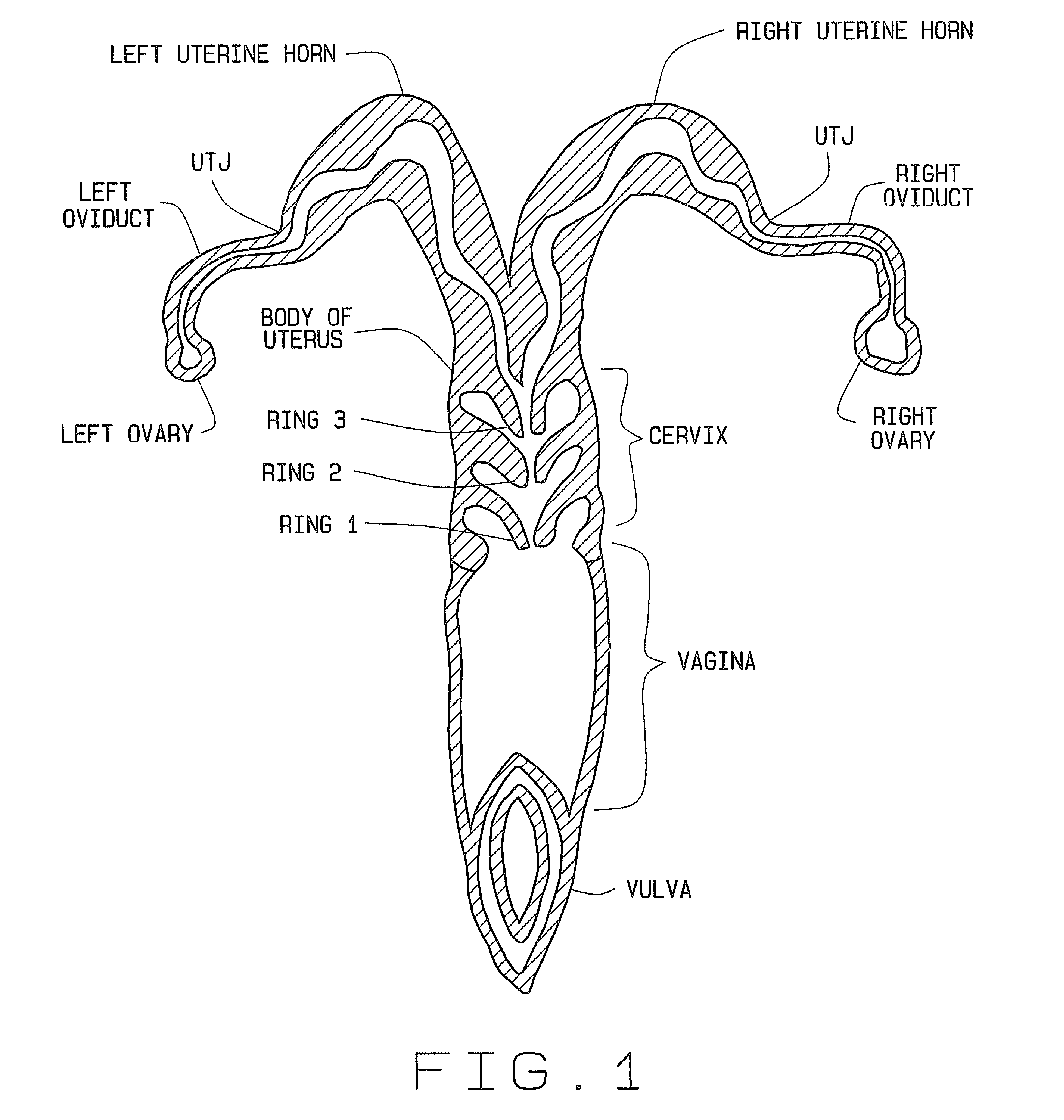 Artificial breeding techniques for bovines including semen diluents and AI apparatus