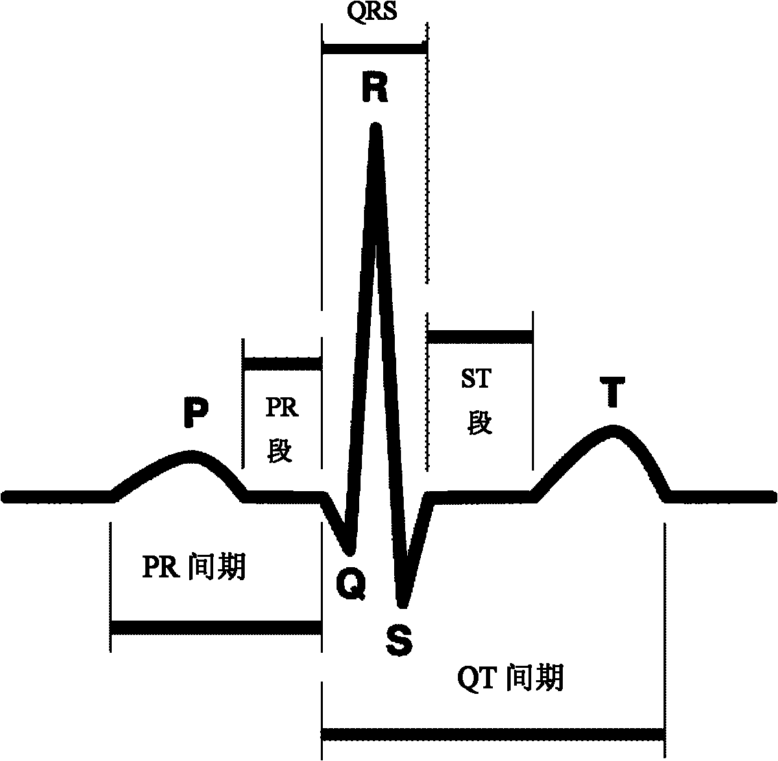 Method and system for extracting electrocardiosignal characteristic