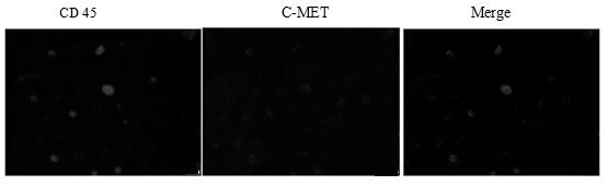 Immunofluorescence kit for detecting C-MET expression of peripheral blood circulating tumor cells of hepatocellular carcinoma patient and detection method