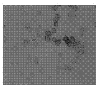 In-situ hybridization screening kit for mRNA (messenger Ribonucleic Acid) level of gene CD2AP of prophase lesion of Alzheimer's disease (AD) and screening method and application thereof