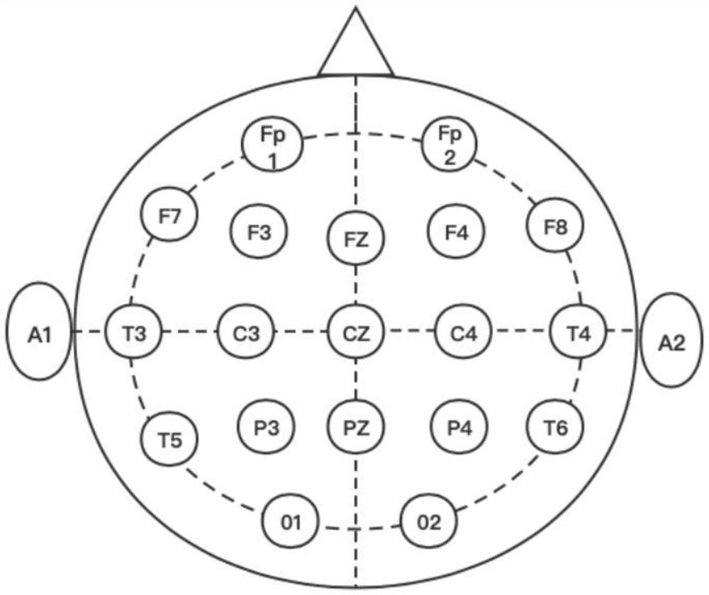 An EEG Signal Classification Method Based on Improved Deep Residual Group Convolutional Network