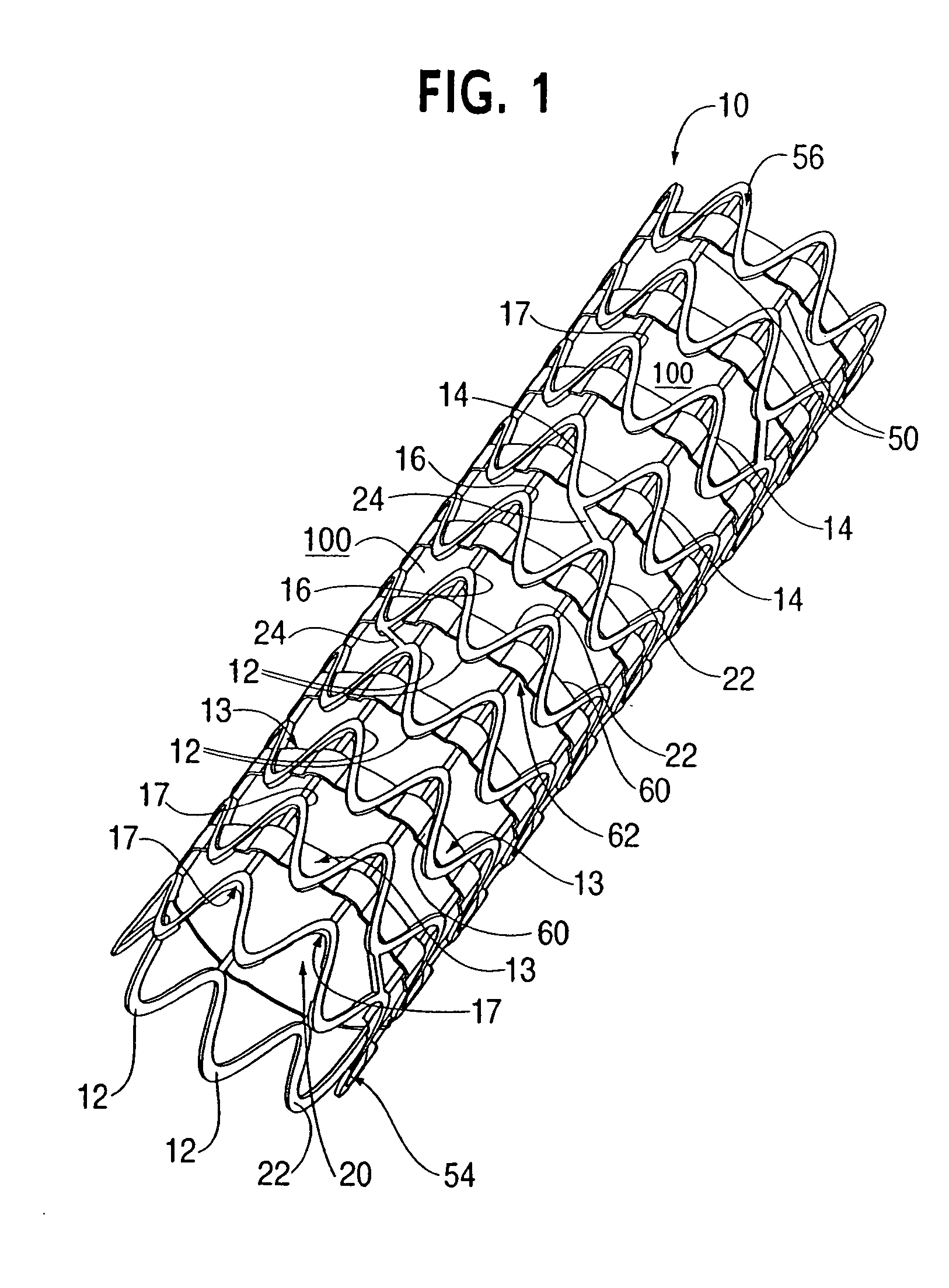 Stent-graft with rails