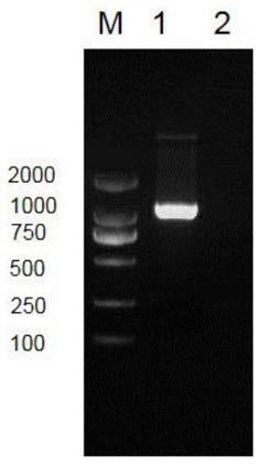 Acetyl xylan esterase gene as well as encoded product and preparation method thereof