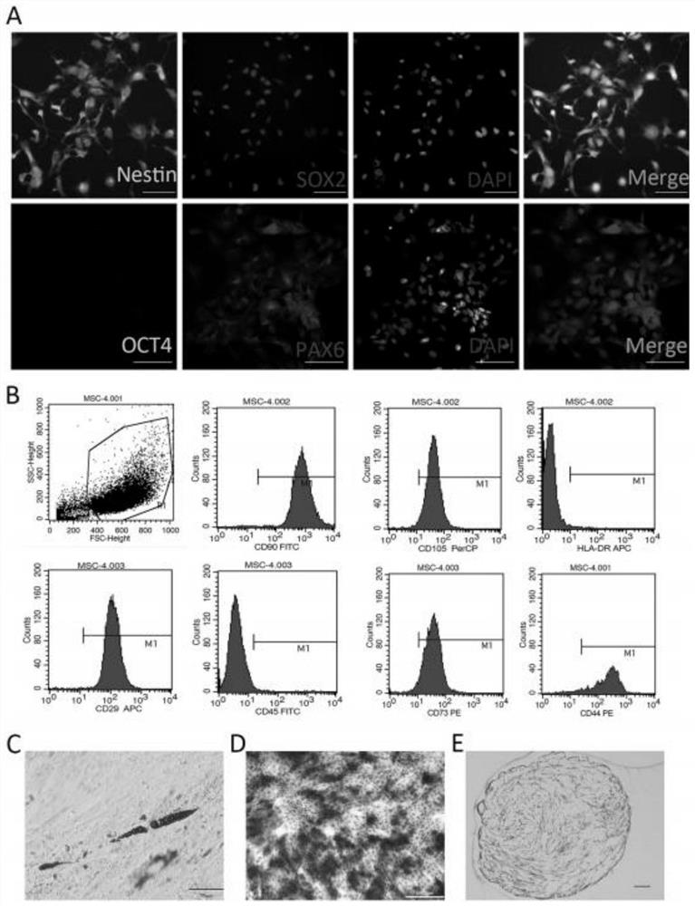 Application of neural stem cells combined with umbilical cord mesenchymal stem cells in spinal cord injury