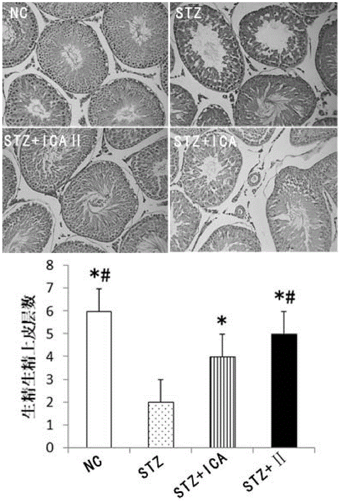 Uses of icariside II in preparation of products for prevention and treatment of reproduction dysfunction