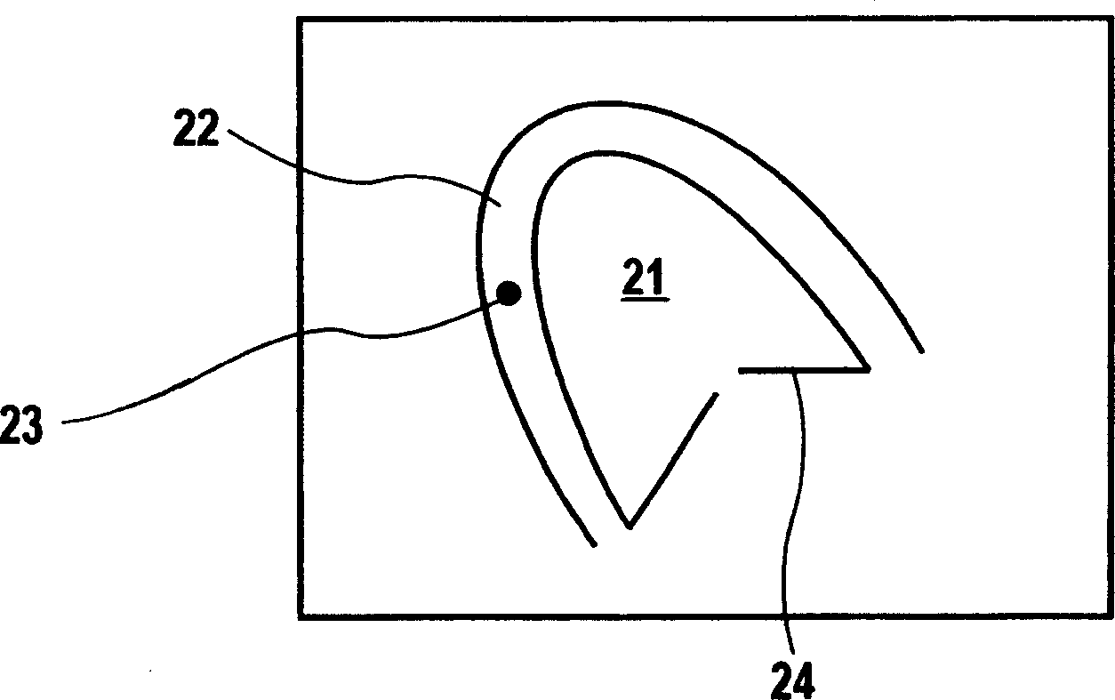 Biological tissue motion trace method and image diagnosis device using the trace method