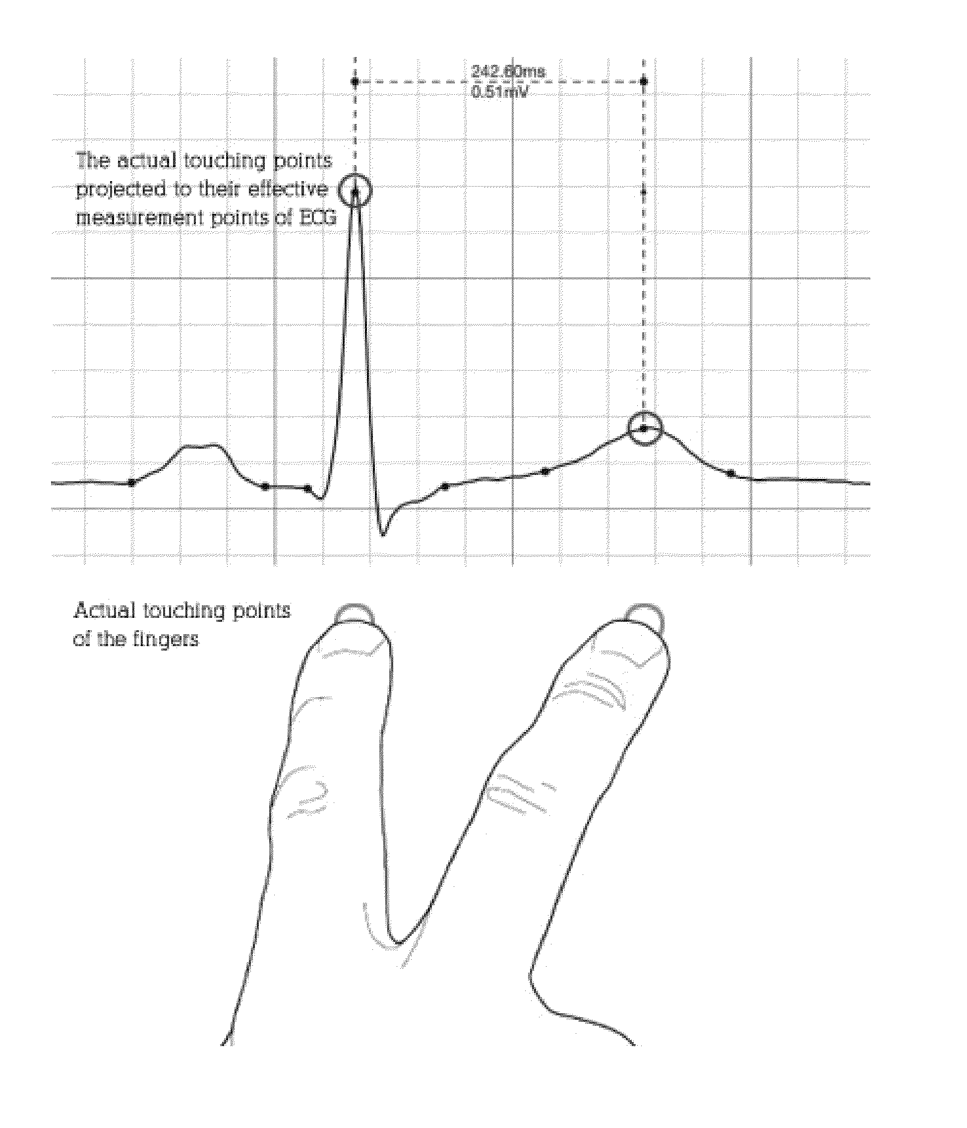 Multi-touch approach for ECG measurement