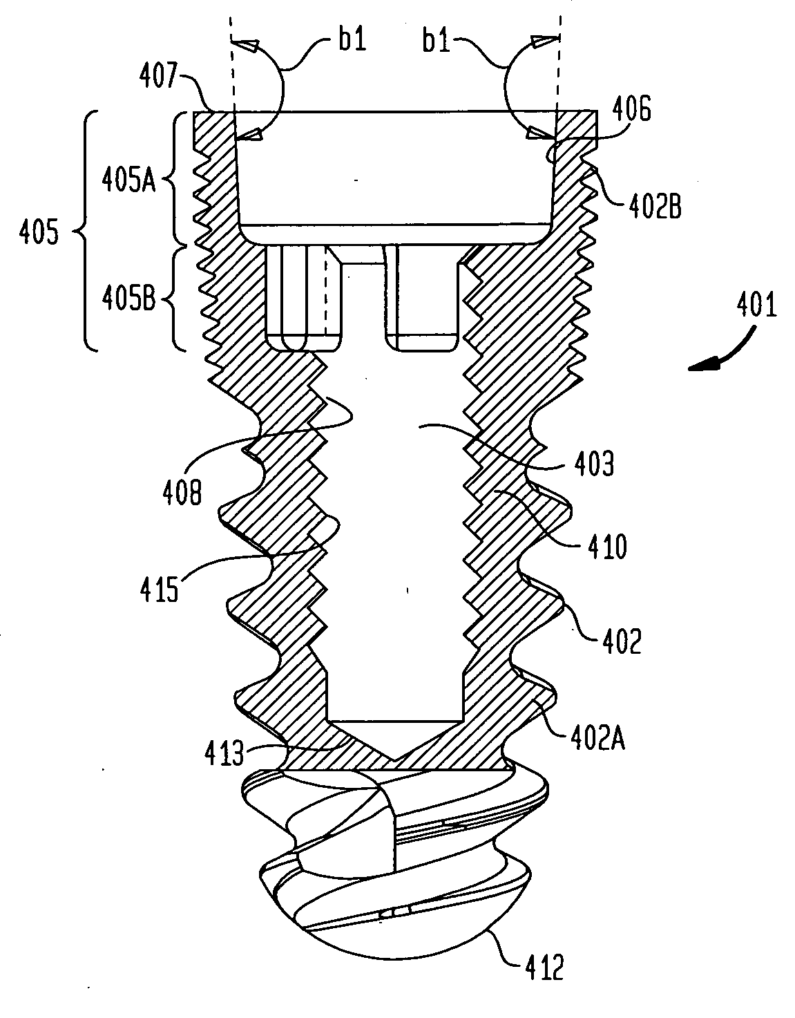 Dental implant and abutment mating system