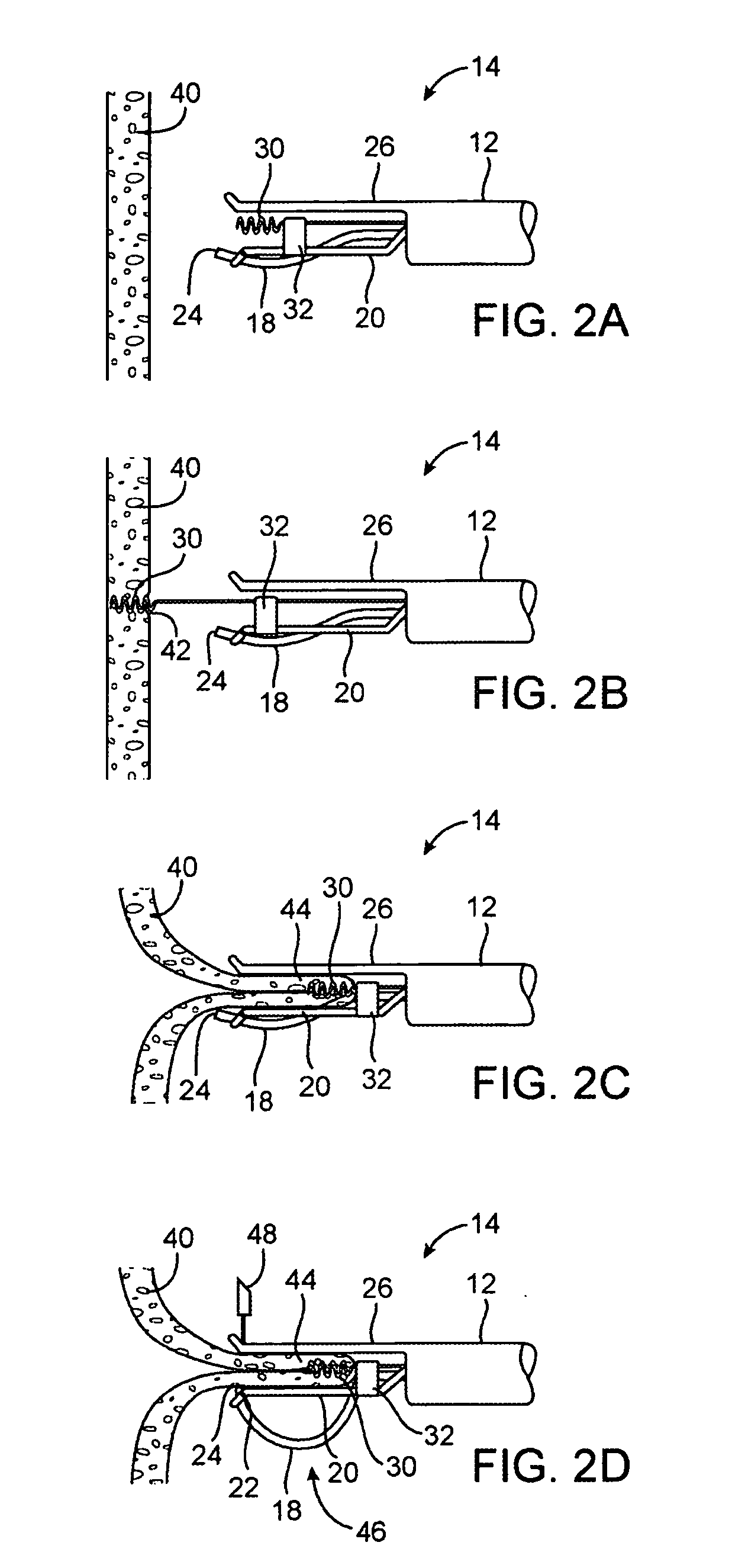 Apparatus and methods for positioning and securing anchors