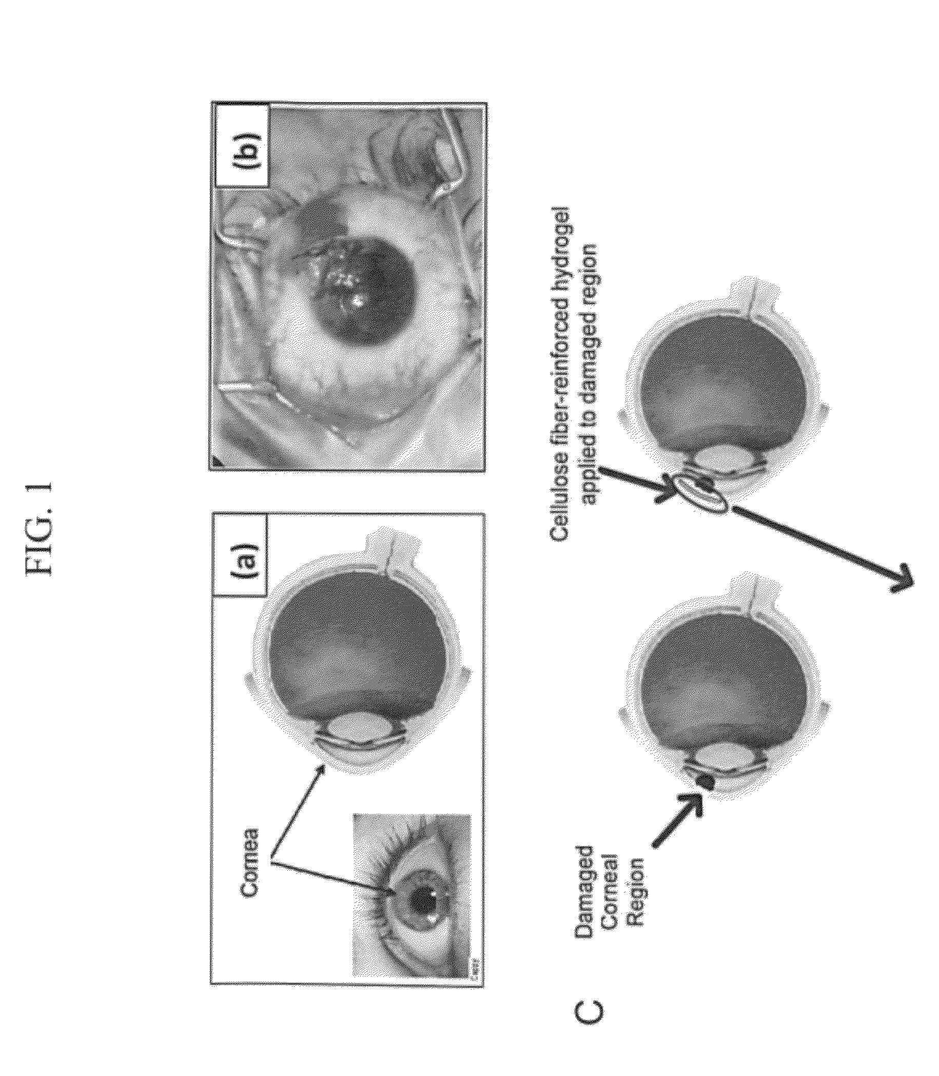 Wound healing compositions comprising biocompatible cellulose hydrogel membranes and methods of use thereof