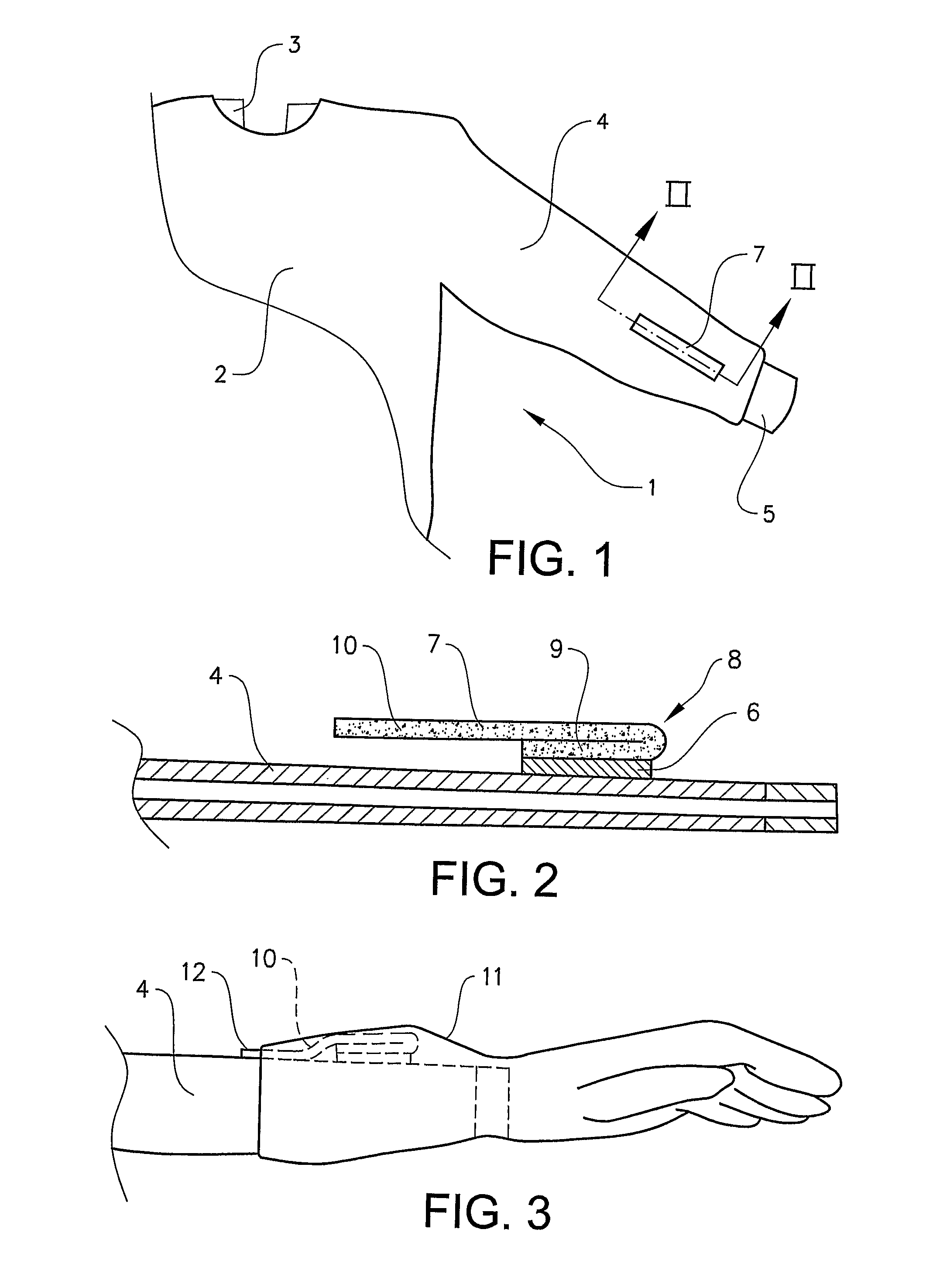 Surgical garment with means for affixing a glove thereto