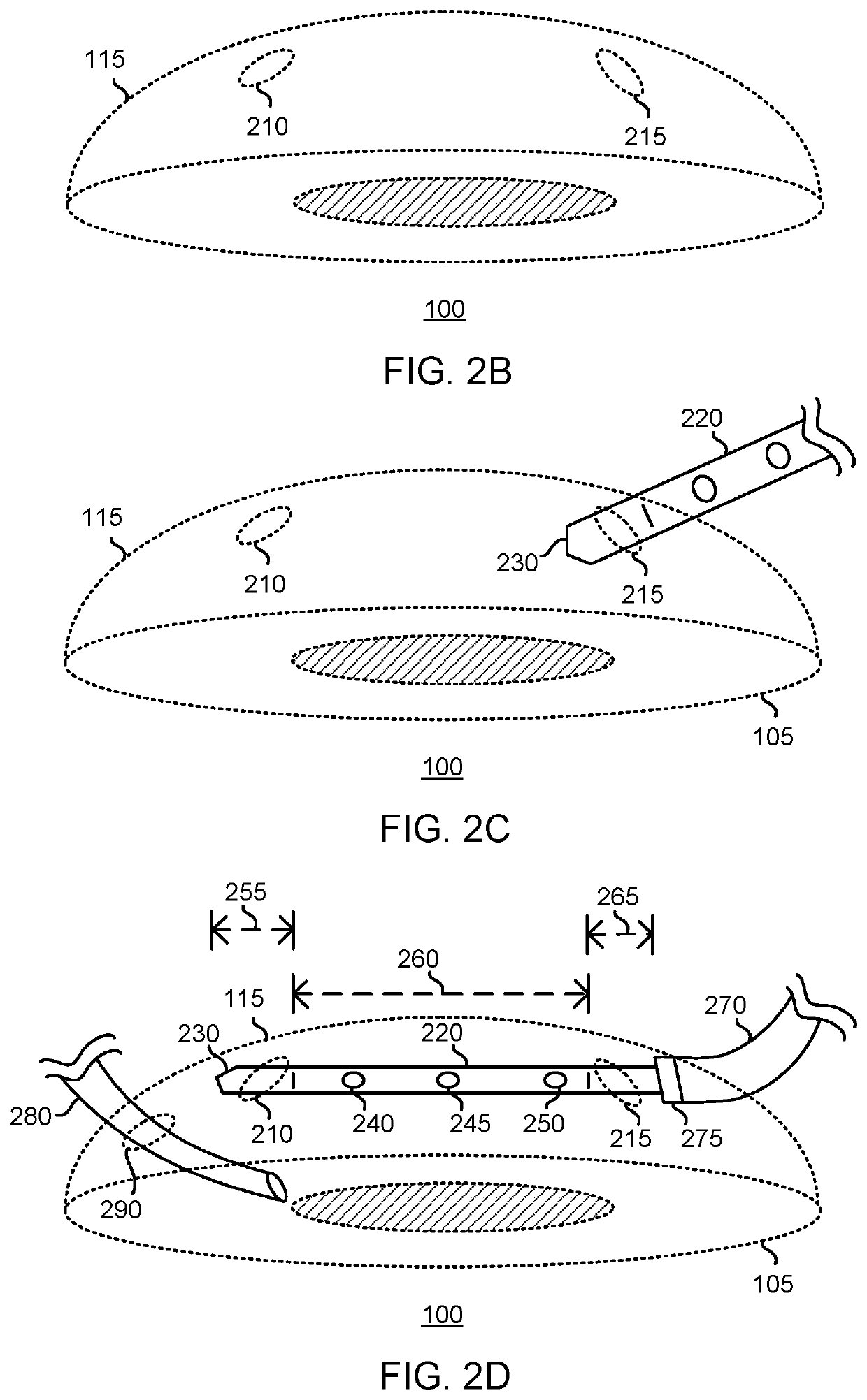 Devices for intraocular surgery