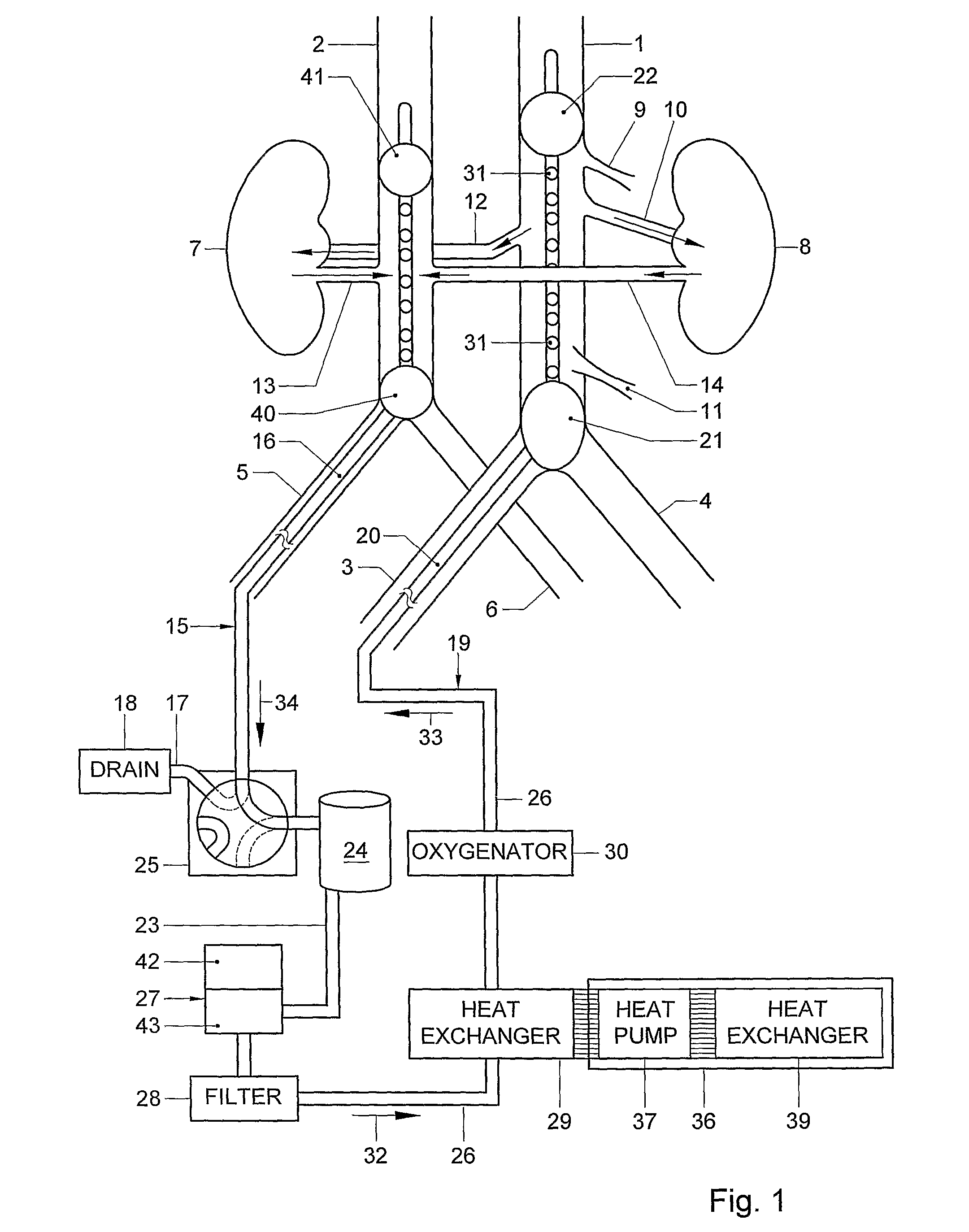 Method and a system for prolongation of the viability of a donor organ