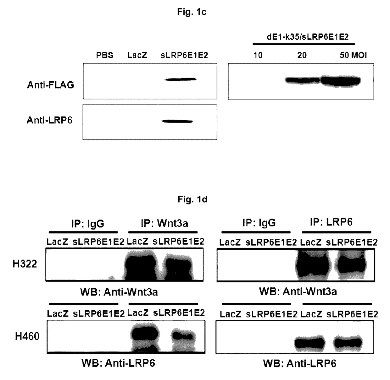 Anti-cancer compositions containing WNT decoy receptor