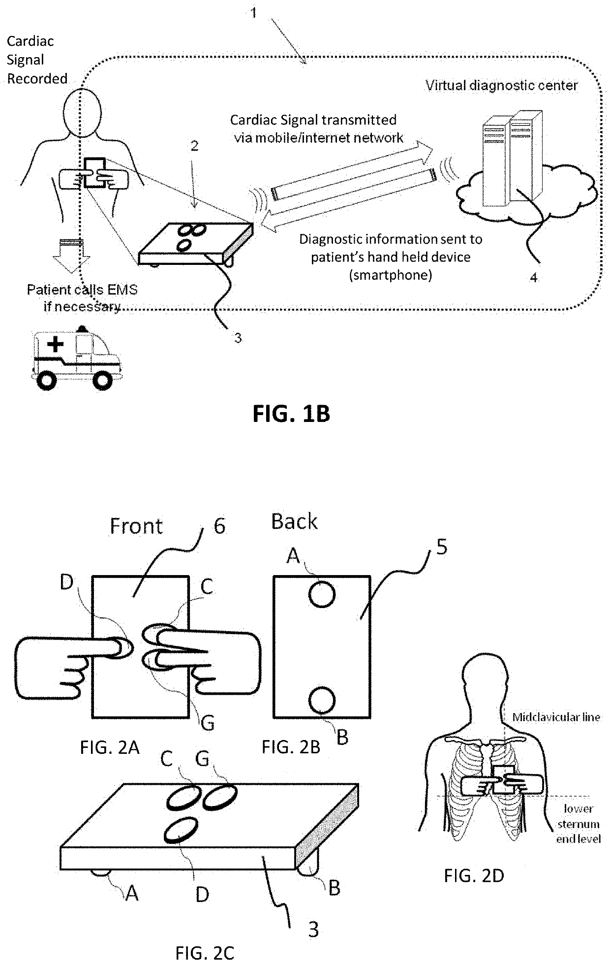 Electrocardiogram patch devices and methods