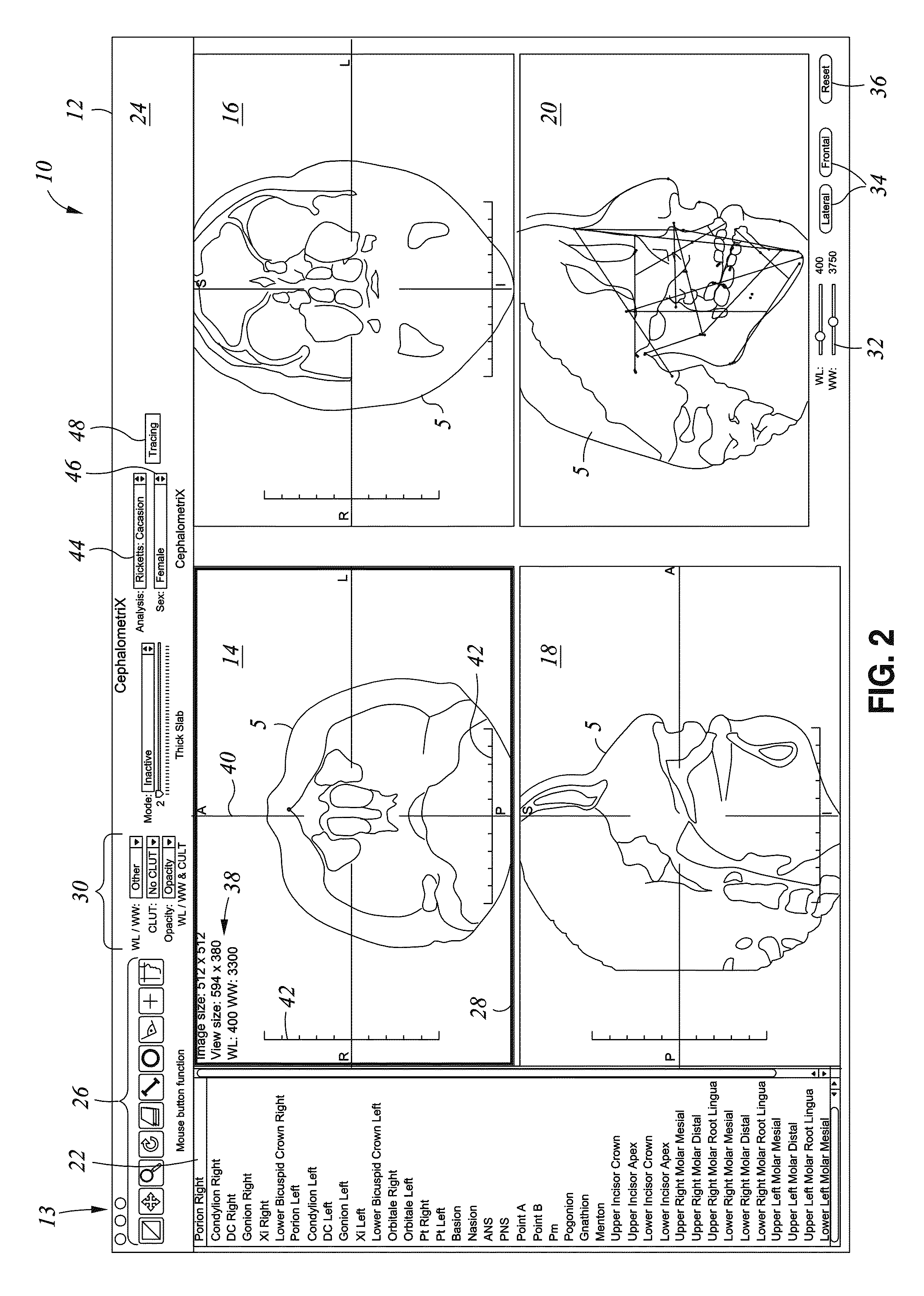 Method and system for orthodontic diagnosis