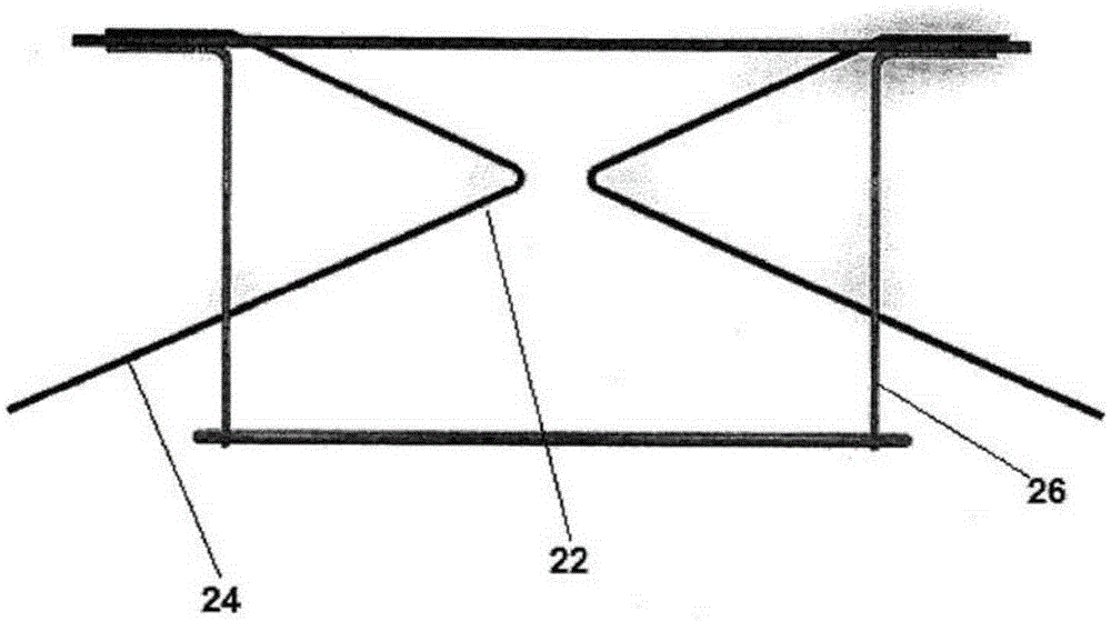 Anchoring elements for intracardiac devices