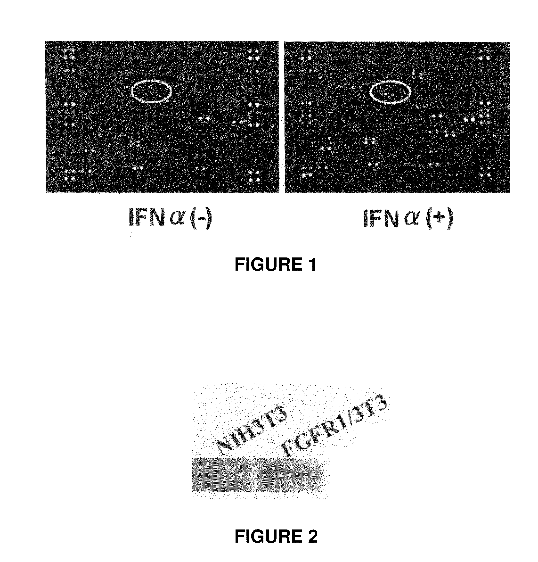 Therapeutic agent for cancer, and method for treatment of cancer