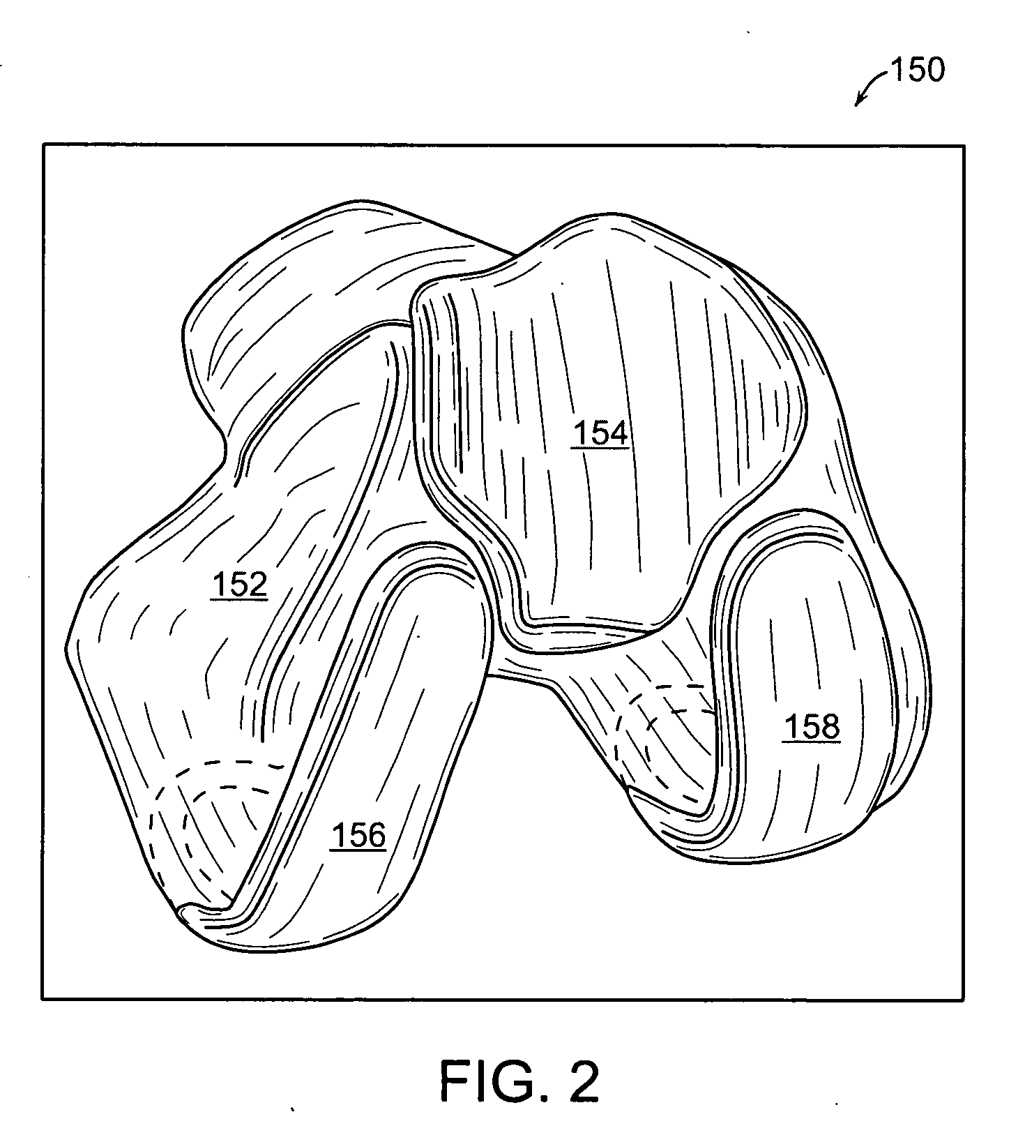 Implant planning using areas representing cartilage