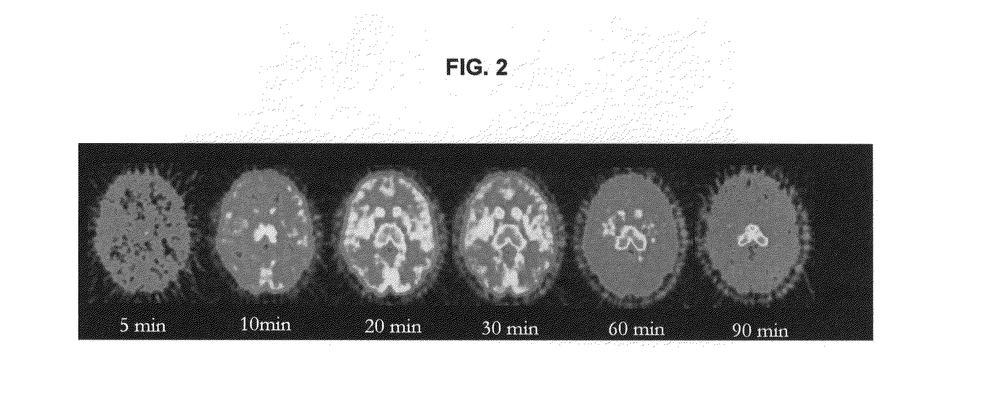 Methods for Diagnosing Diseases and Evaluating Treatments Therefor Using Pet