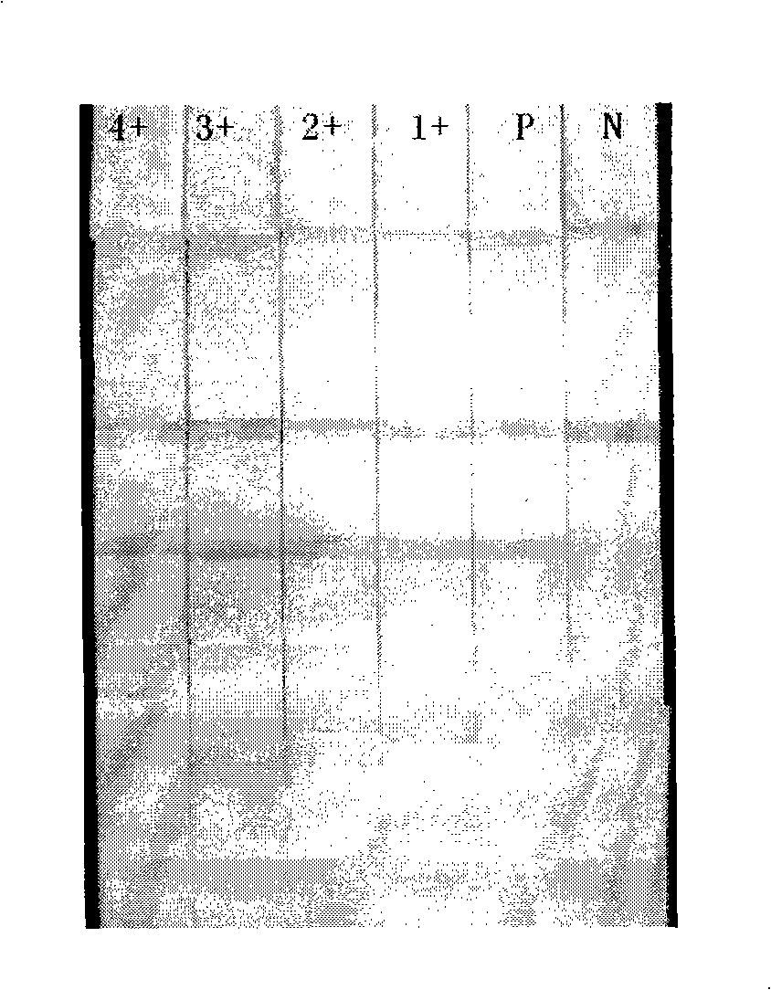 Method for quickly processing filter-type micro nucleic acid clinical samples