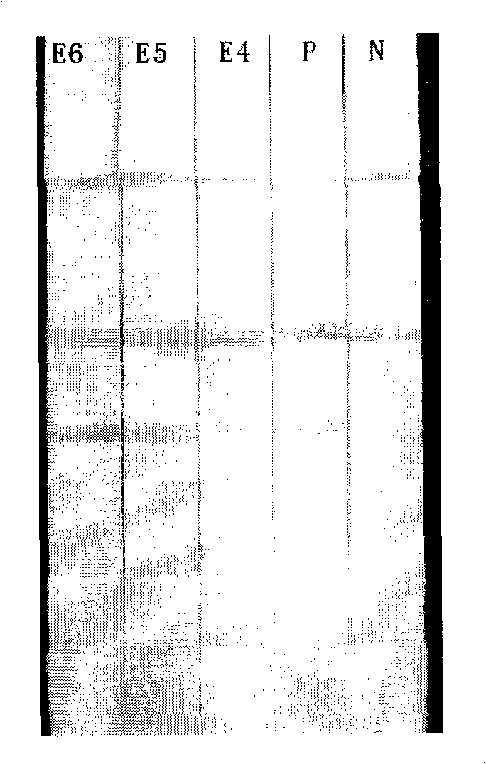 Method for quickly processing filter-type micro nucleic acid clinical samples