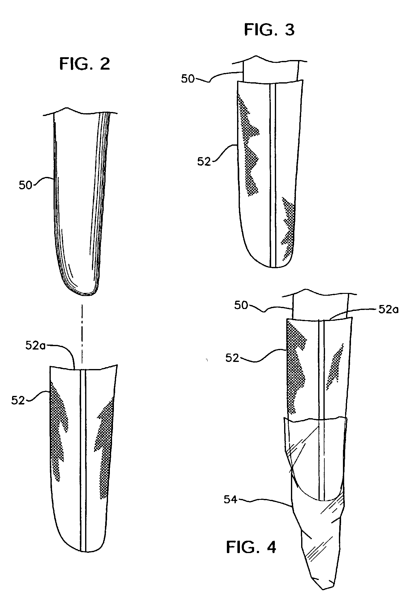 Apparatus for casting a prosthetic socket under vacuum