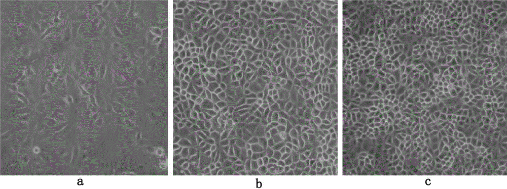 Method for producing propagation and respiratory tract syndrome CH-1R strain viruses for pigs by seroculturing Marc-145 cells