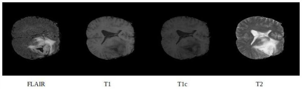 Medical image target area identification method, neural network model and application