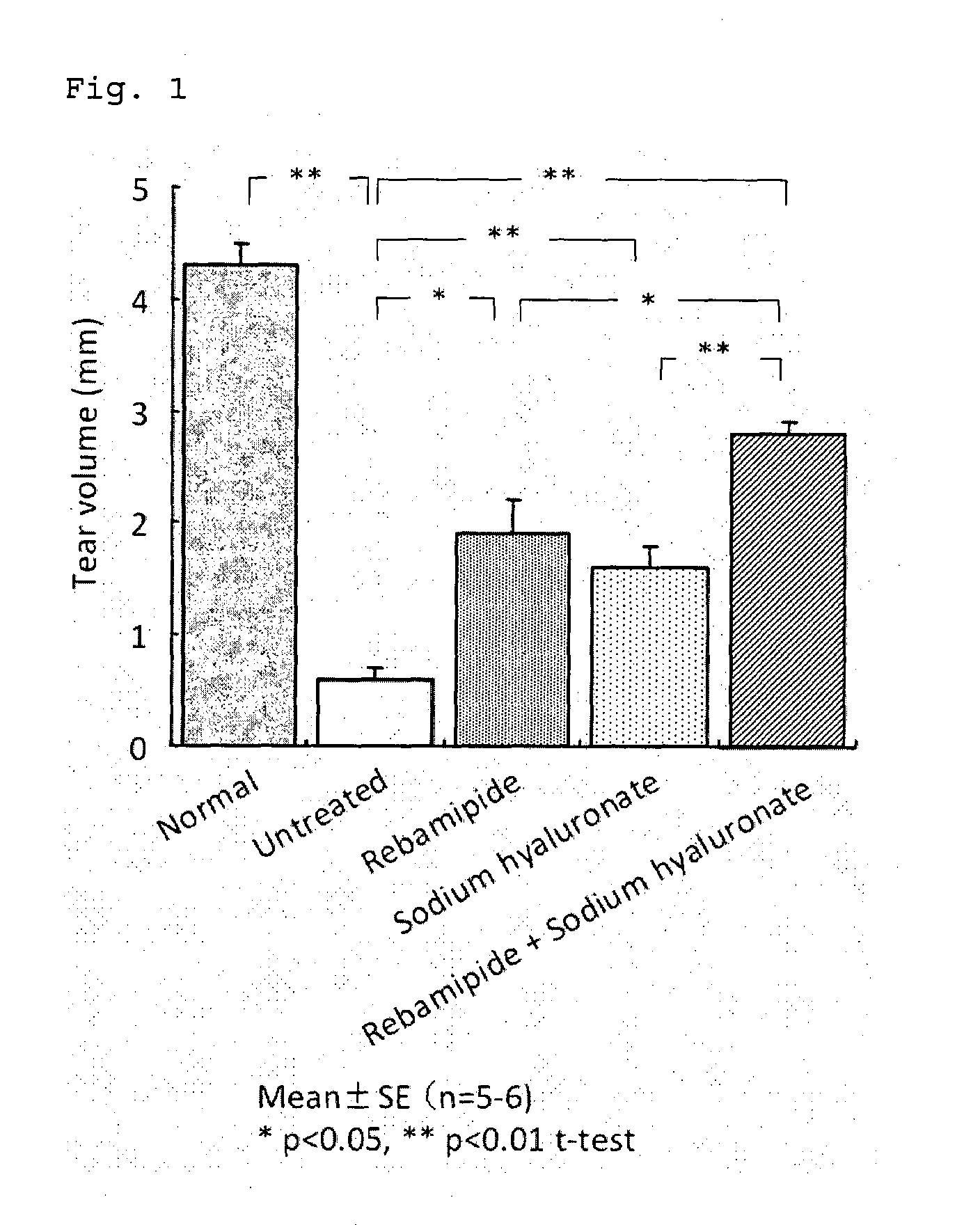 Medicament for treating anterior eye disease comprising rebamipide and a tear-retaining agent