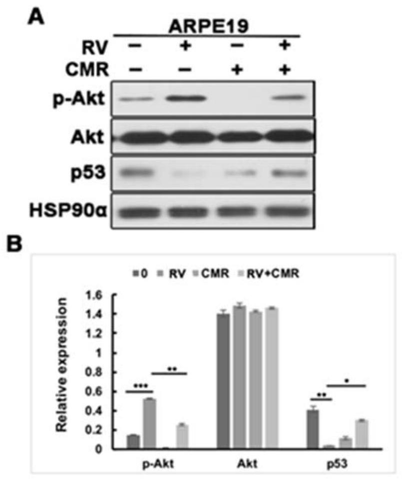Applications of Chalcomoracin and homologues thereof in preparation of drugs for treatment of proliferative vitreoretinopathy