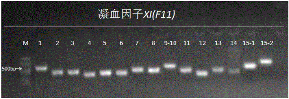 Method and primer for detecting hereditary blood coagulation factor XI(F11) genes