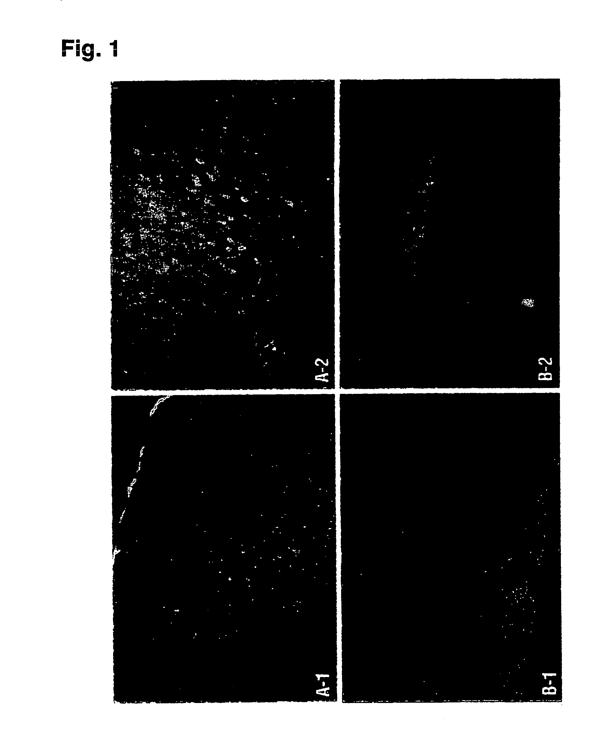 Decoy compositions for treating and preventing brain diseases and disorders