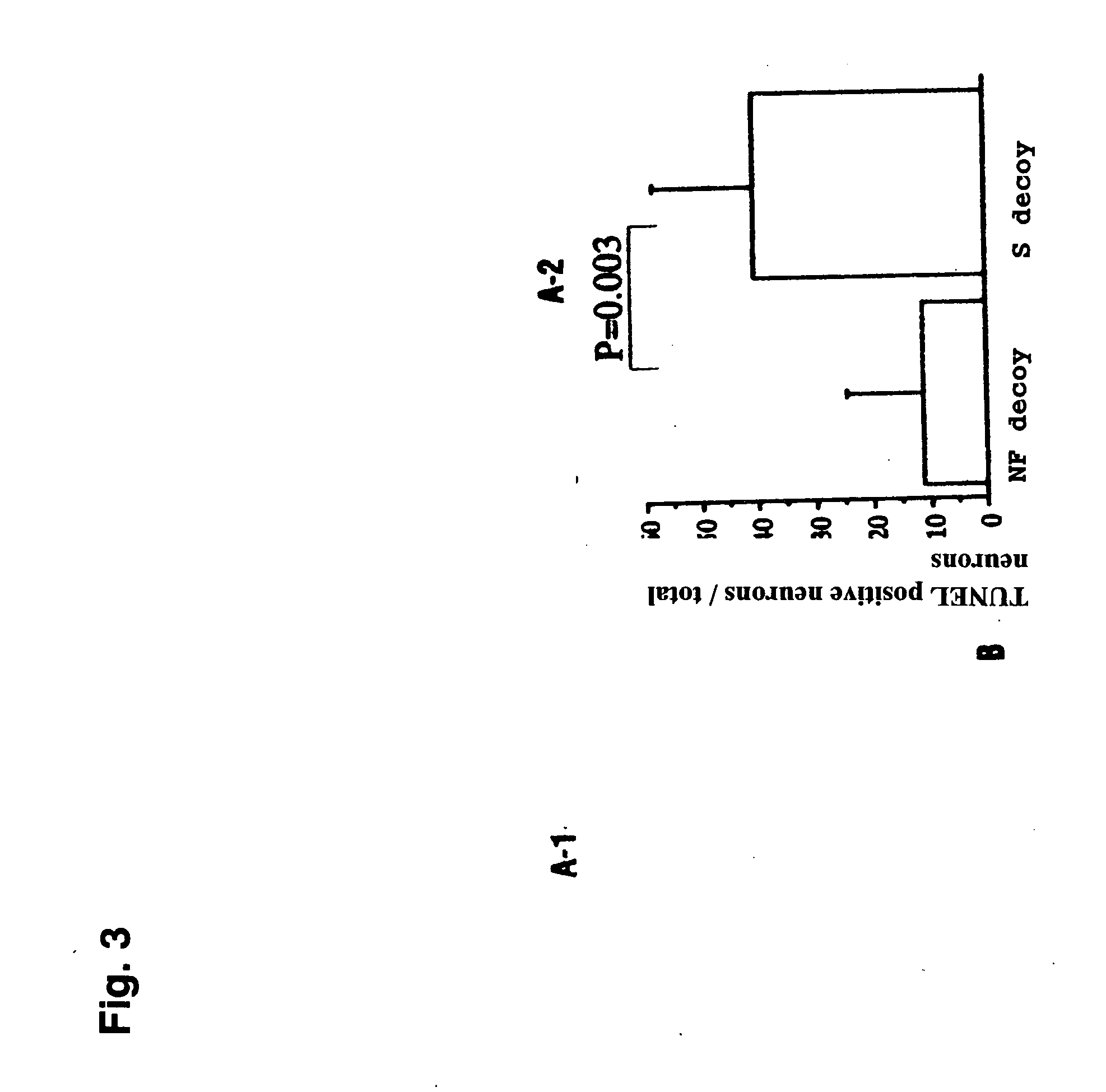 Decoy compositions for treating and preventing brain diseases and disorders