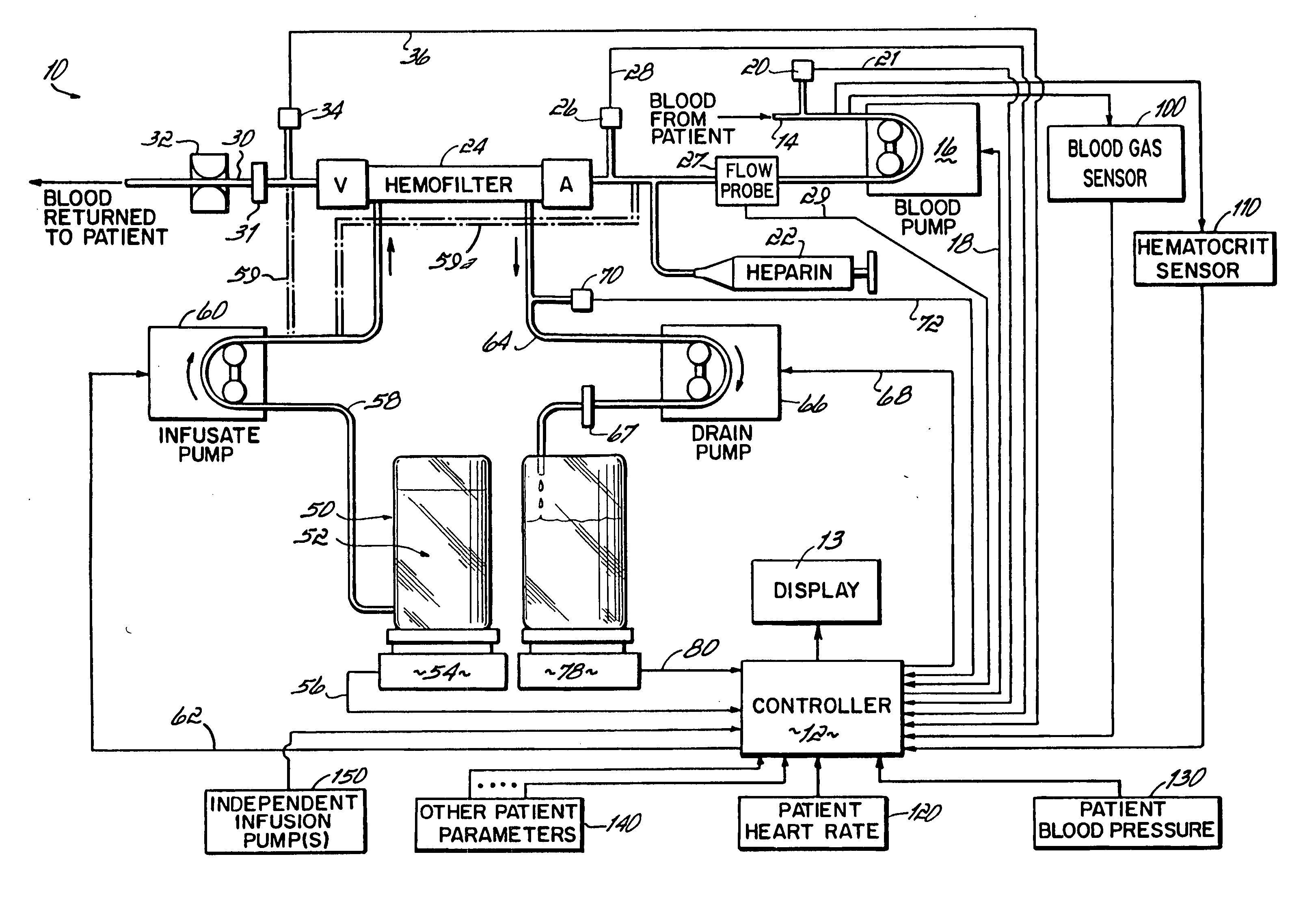 Hemofiltration system and method based on monitored patient parameters, supervisory control of hemofiltration, and adaptive control of pumps for hemofiltration
