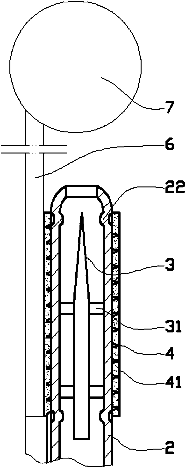 Ear canal cyst extraction device