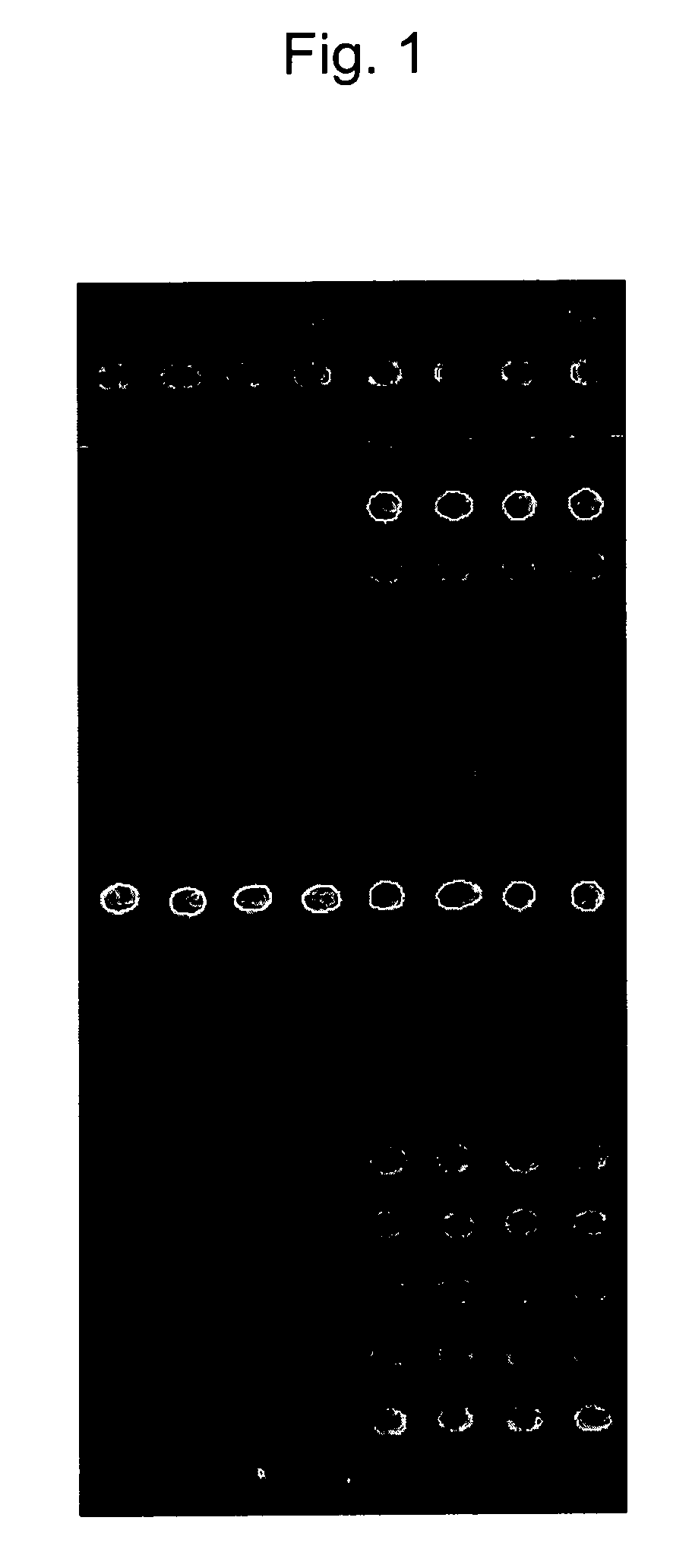 Β-catenin oligonucleotide microchip and method for detecting β-catenin mutations employing same