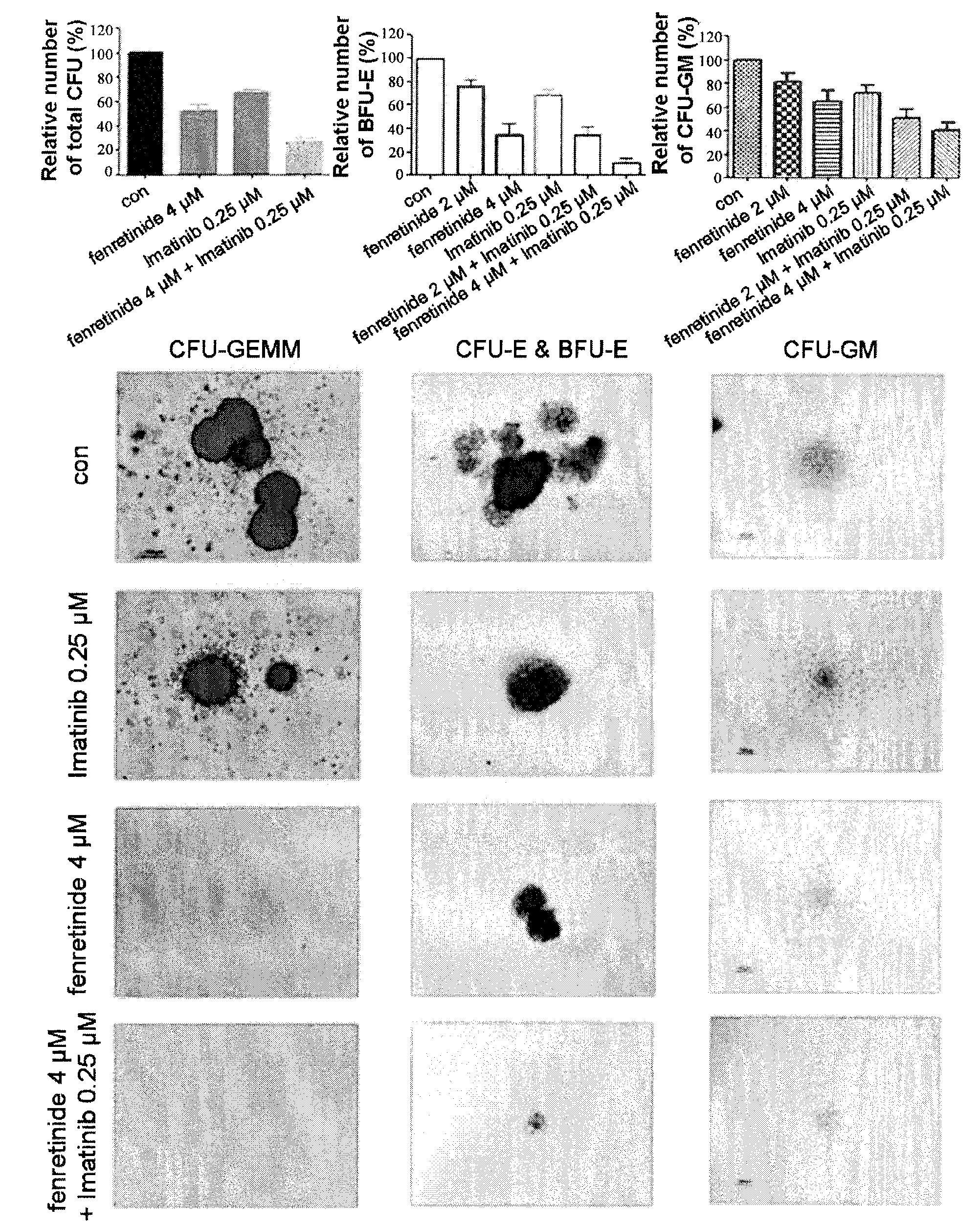 Use of Fenretinide or Bioactive Derivatives Thereof and Pharmaceutical Compositions Comprising the Same