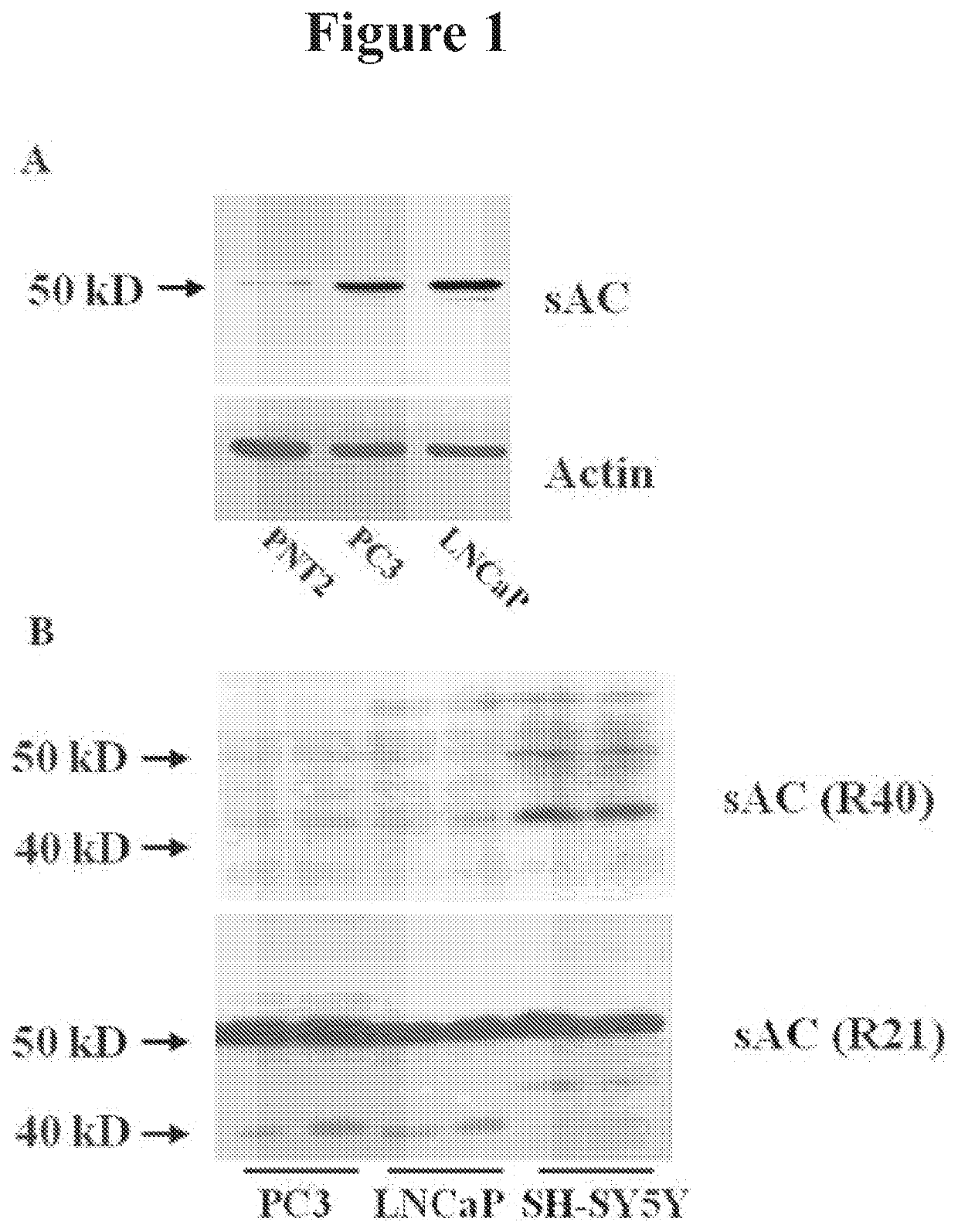 Methods for diagnosing and treating prostate cancer