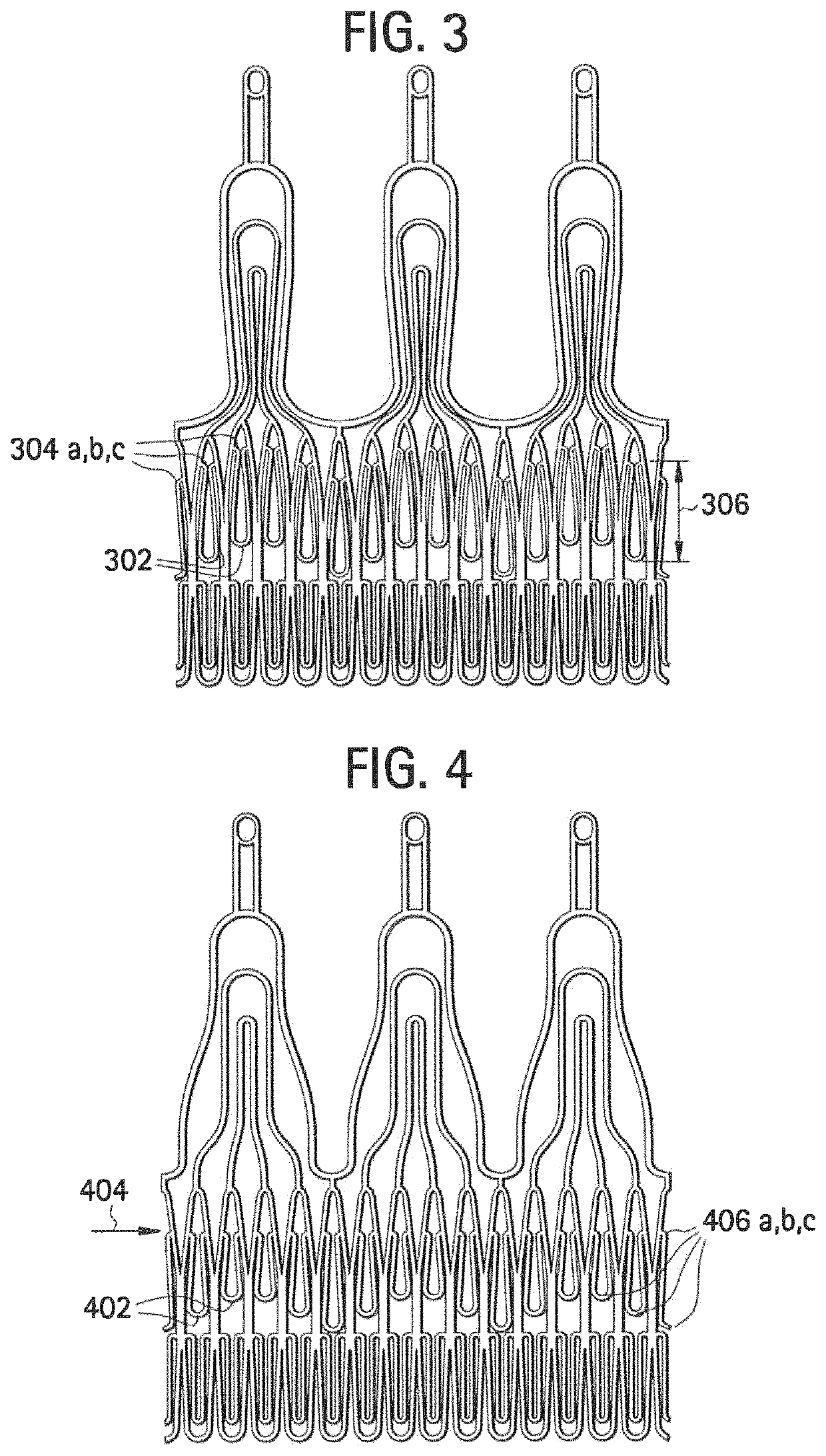 Stent-valves for valve replacement and associated methods and systems for surgery