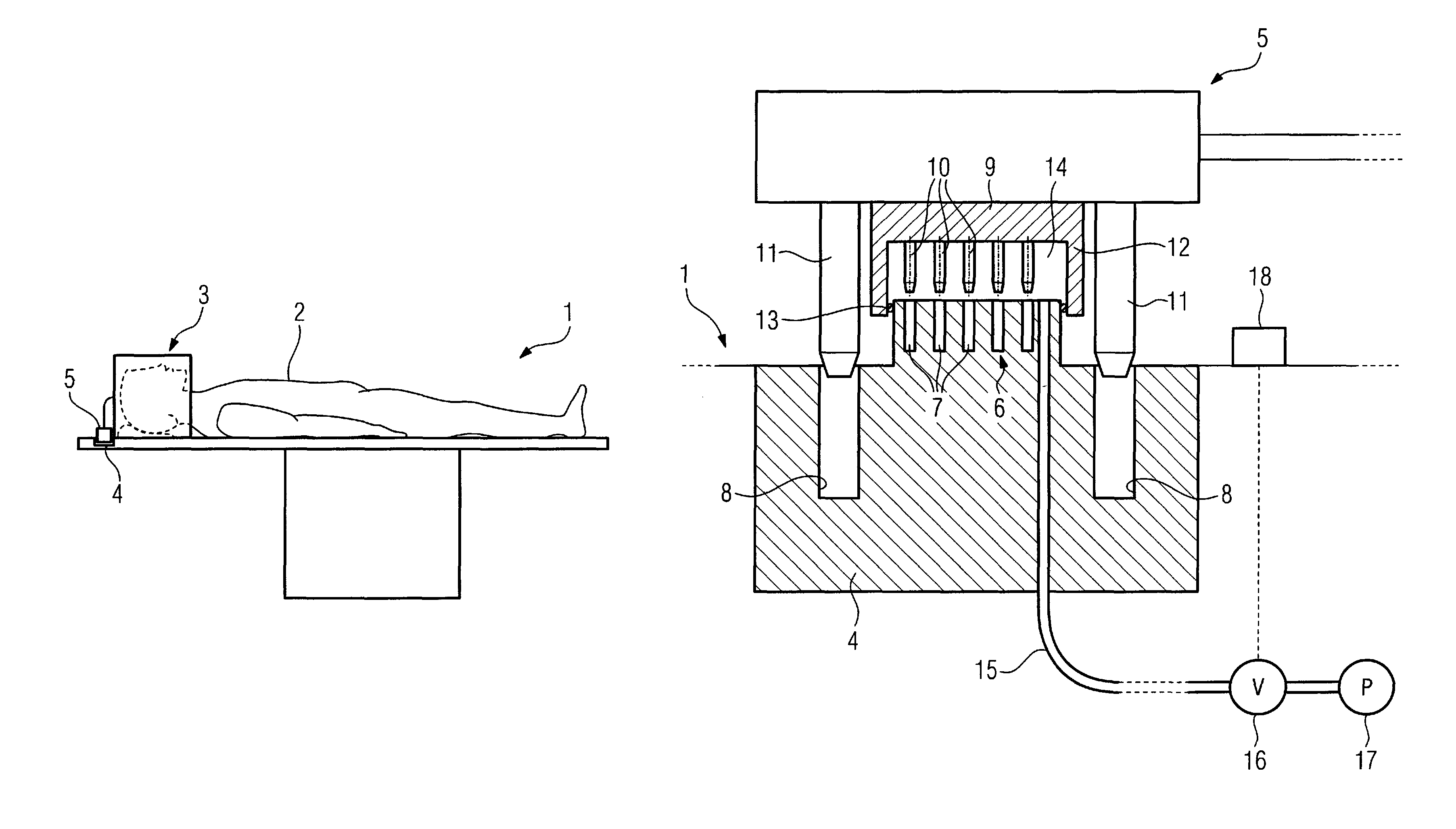Patient bed with force generator to assist or effect movement of a device plug in a bed socket